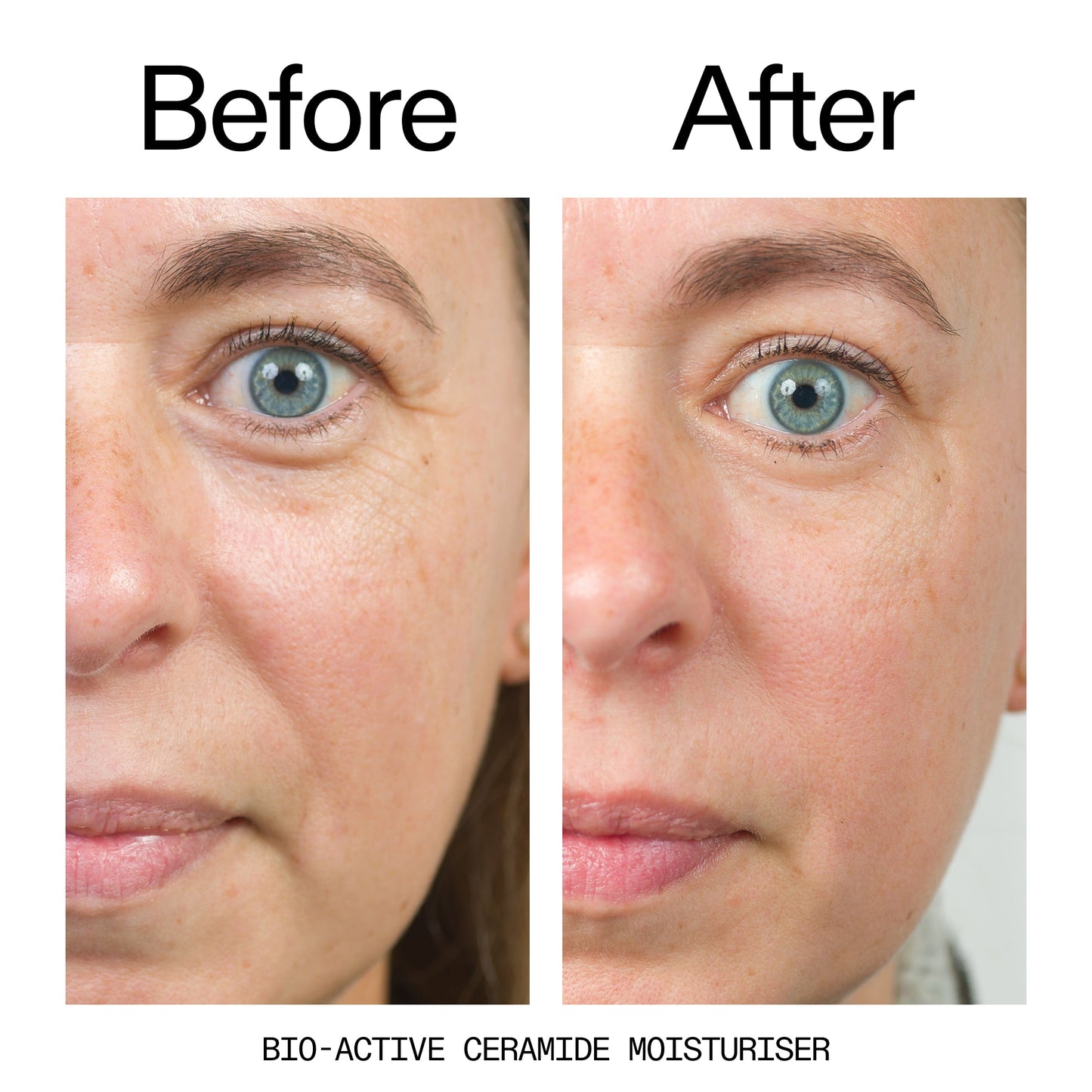 barrier-boosting-trio-k5 Bio-Active_Before_After_2000x2000_600947b4-e8c5-425a-9155-fc15bc83aa12.jpg