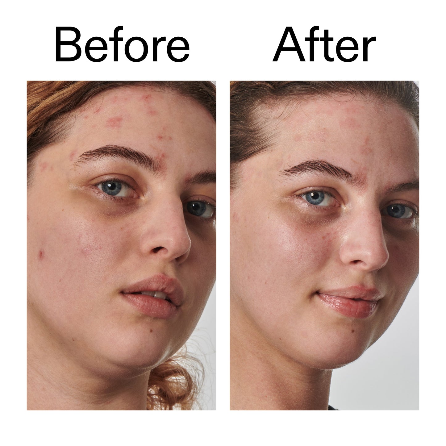 10-urea-moisturizer-s6 Dry_and_Rough_Skin_Solution_Before_After_2000x2000_efa6e639-5c39-49bd-a5dd-f0220293120a.jpg