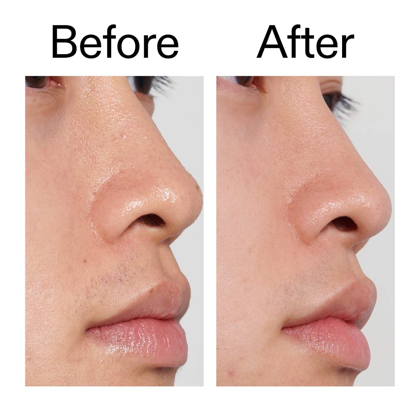 pha-toner-y4 PHA_Toner_Before_After_2000x2000_e3c10172-0150-4342-8b95-57417eaff50d.jpg