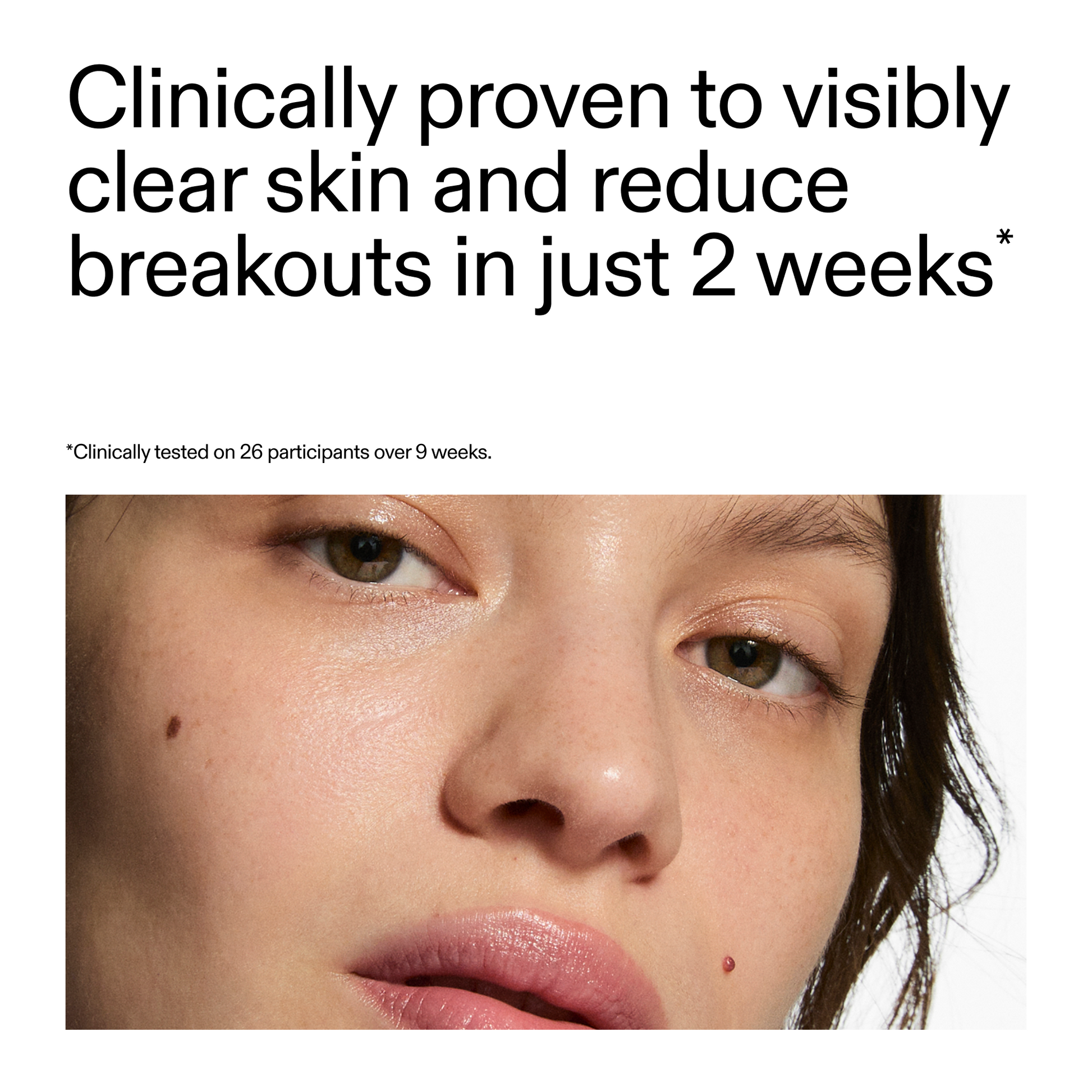 360-acne-clearing-duo-a5 360_Serum_Key_Claim.png