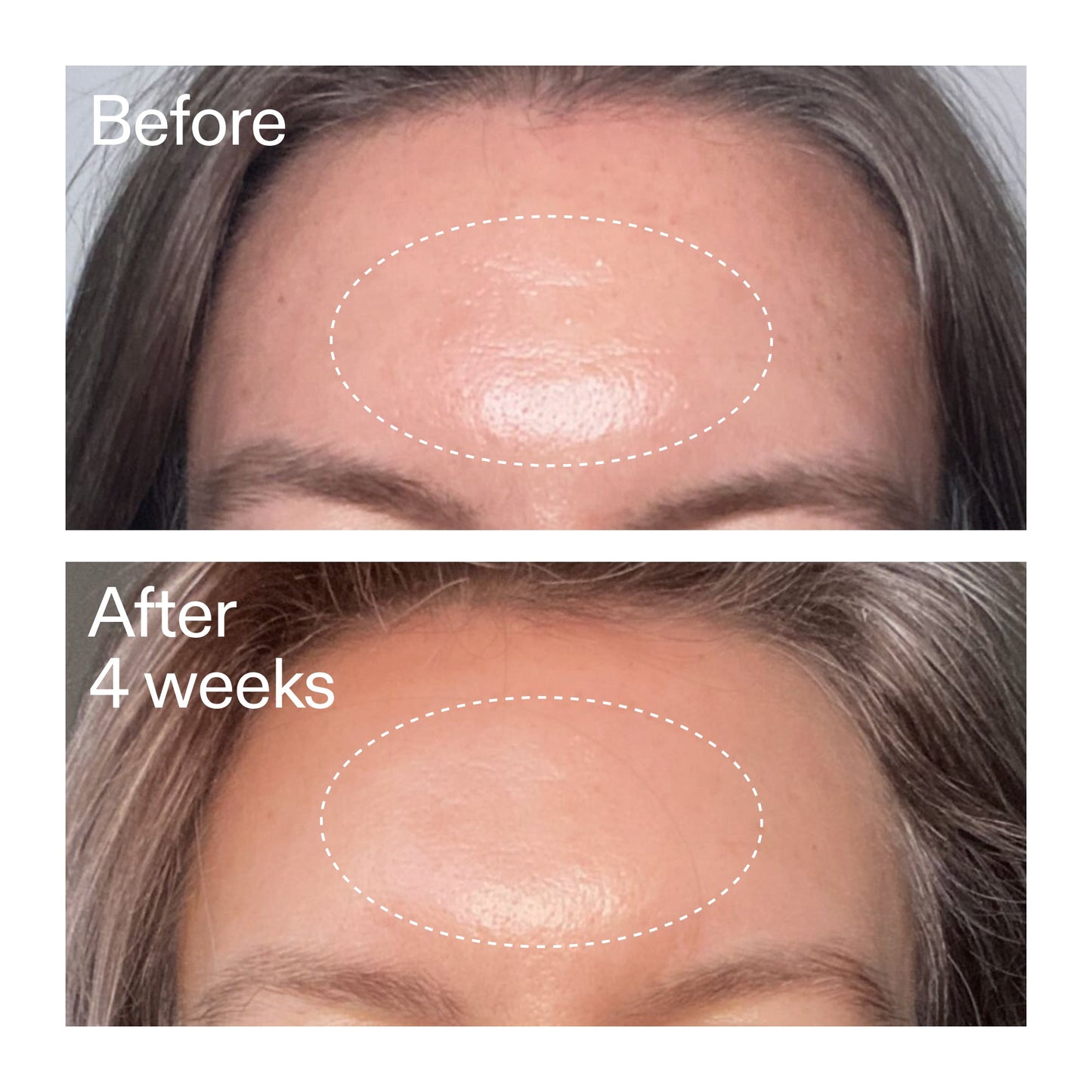 advanced-0-2-retinal-serum-v8 AdvancedRetinal_BeforeAfter1_2000x2000_1da6bb0a-29dd-41d1-95b7-8679696bbf0f.jpg