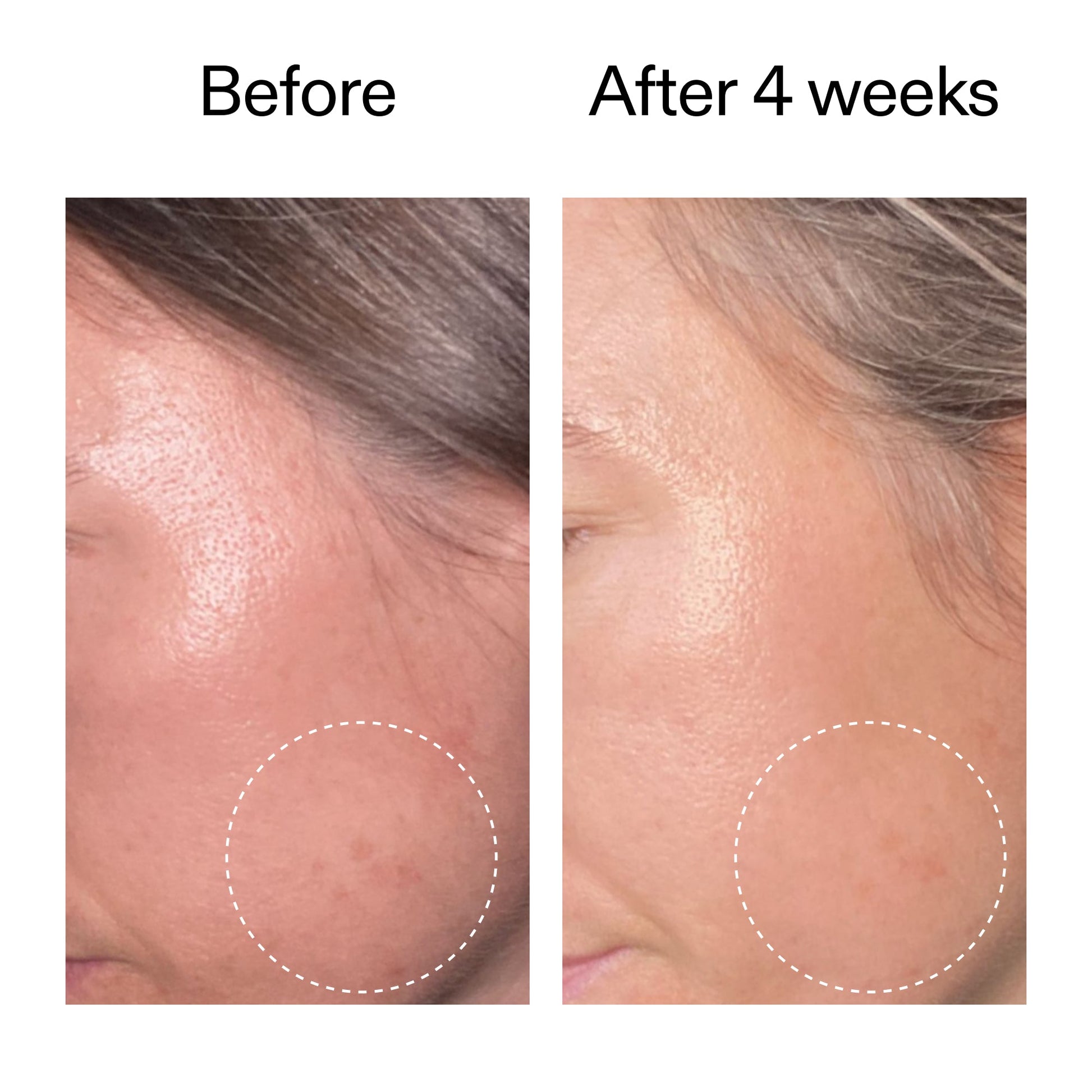 advanced-0-2-retinal-serum-v8 AdvancedRetinal_BeforeAfter2__2000x2000_62fb16bb-77ae-4d63-8500-88dbf847f4b9.jpg