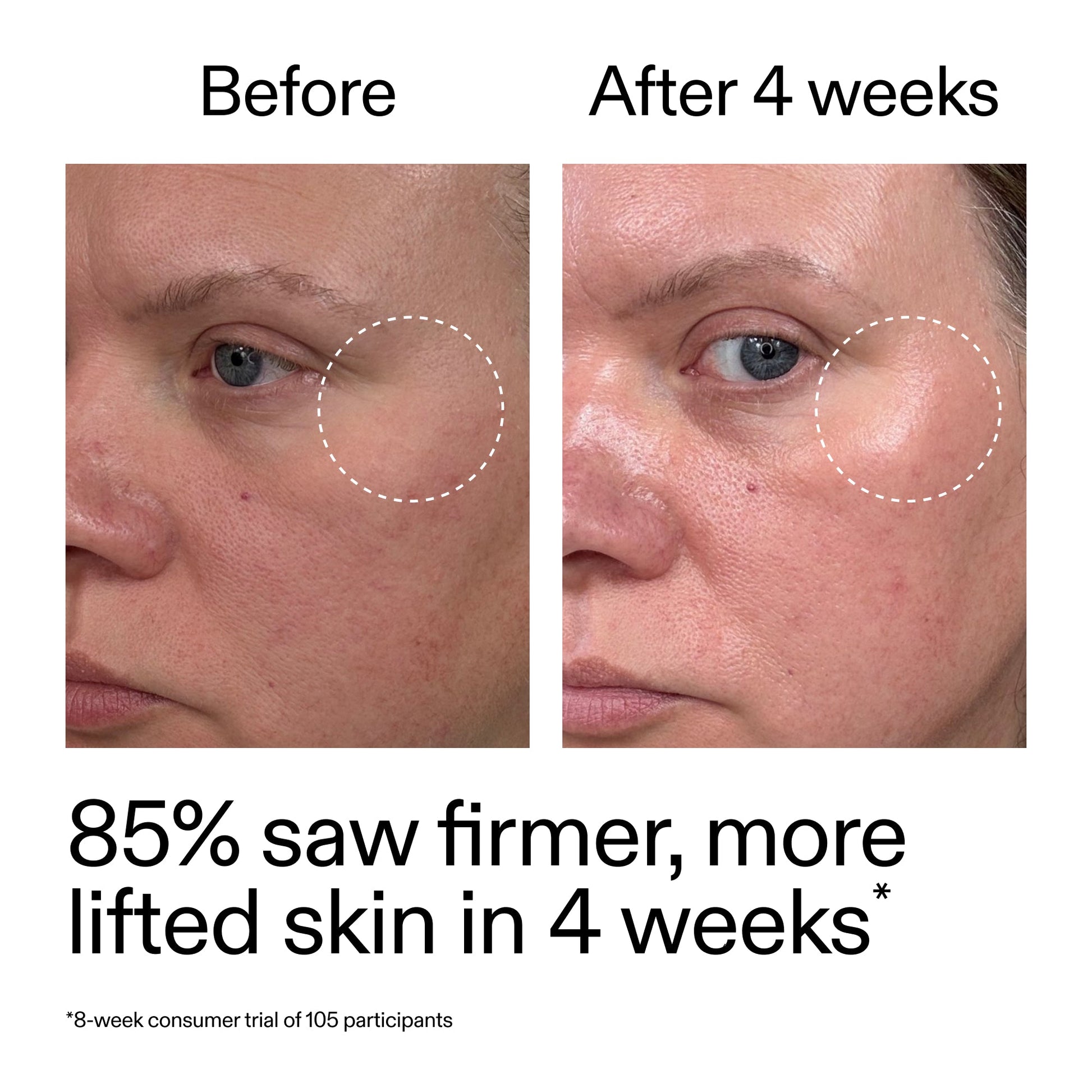 advanced-0-2-retinal-serum-duo-c8 AdvancedRetinal_BeforeAfter_Claim1_2000x2000_3a315aa8-f408-4b33-bbeb-0d9209f98404.jpg