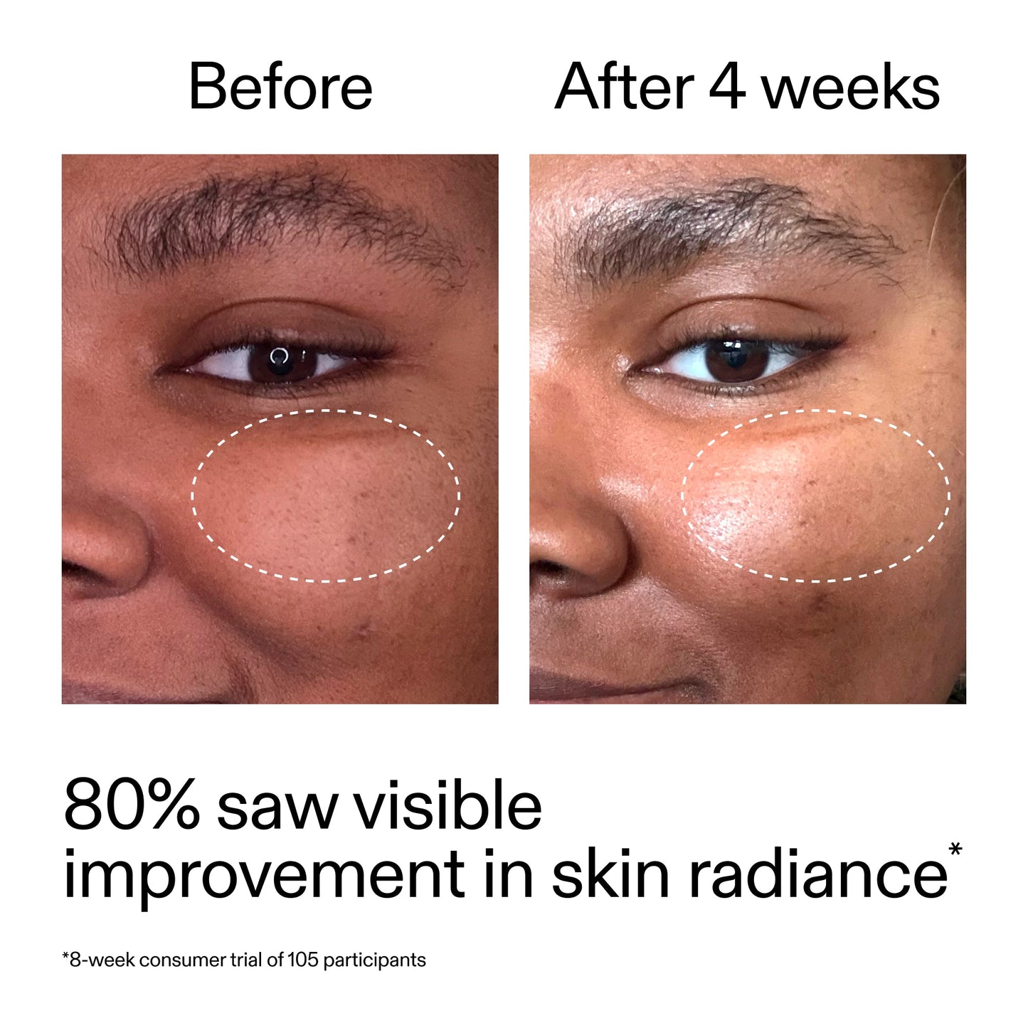 advanced-0-2-retinal-serum-v8 AdvancedRetinal_BeforeAfter_Claim2_2000x2000_39d11e3d-eda9-44ec-ab32-2903b1a368bd.jpg