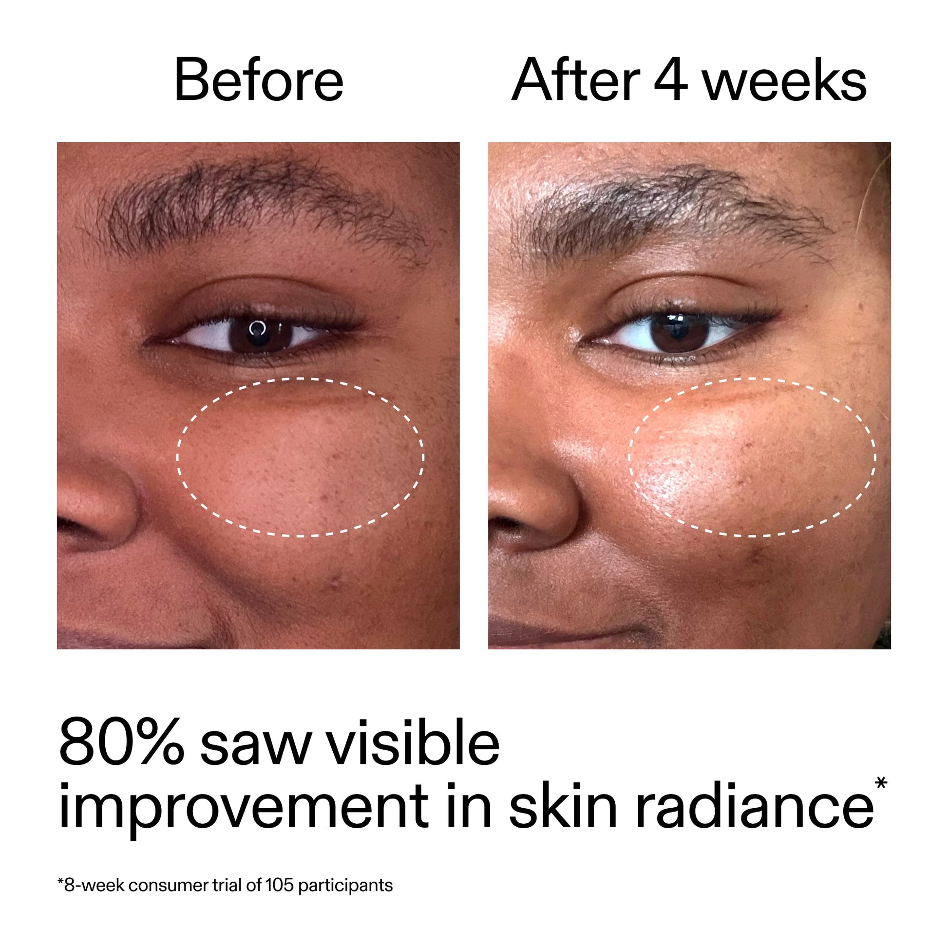 advanced-0-2-retinal-serum-v8 AdvancedRetinal_BeforeAfter_Claim2_2000x2000_39d11e3d-eda9-44ec-ab32-2903b1a368bd.jpg