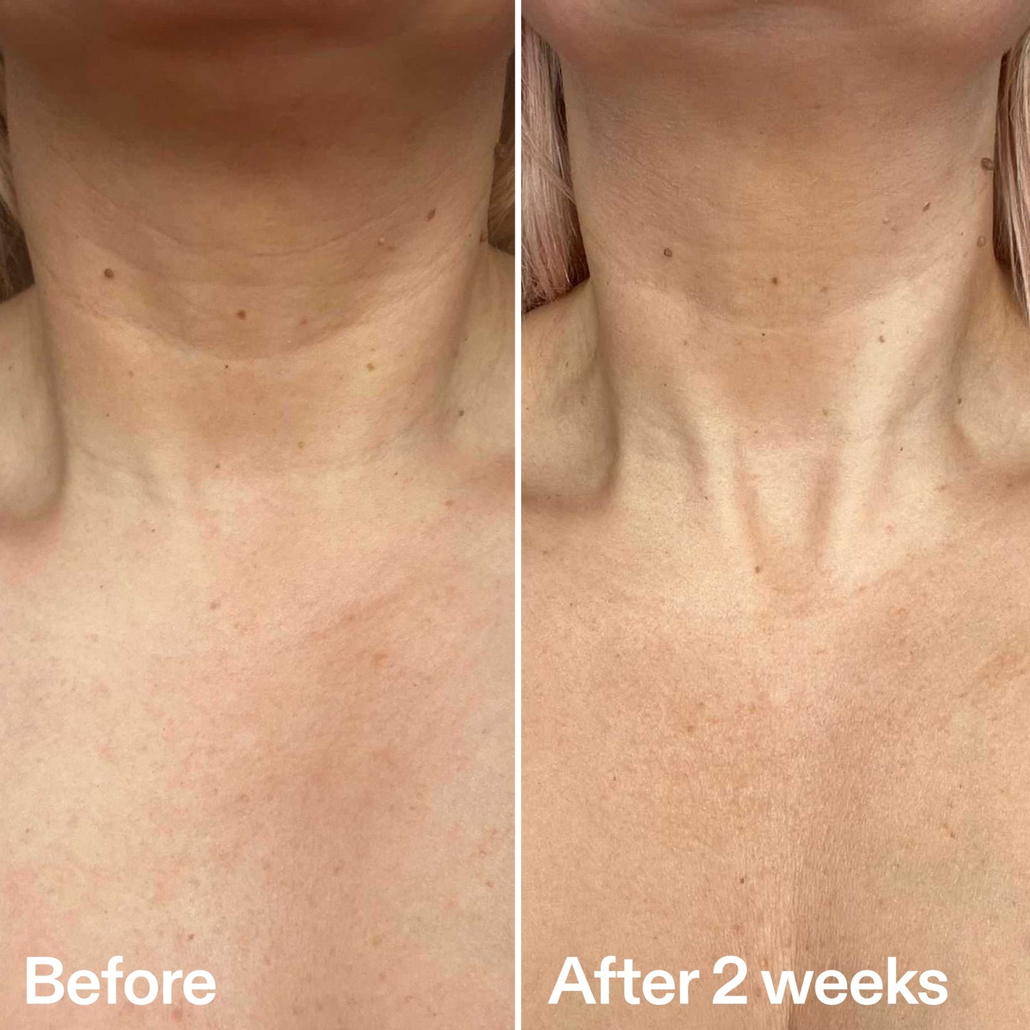 bio-active-neck-lift-stick-e0 B_A_2.jpg