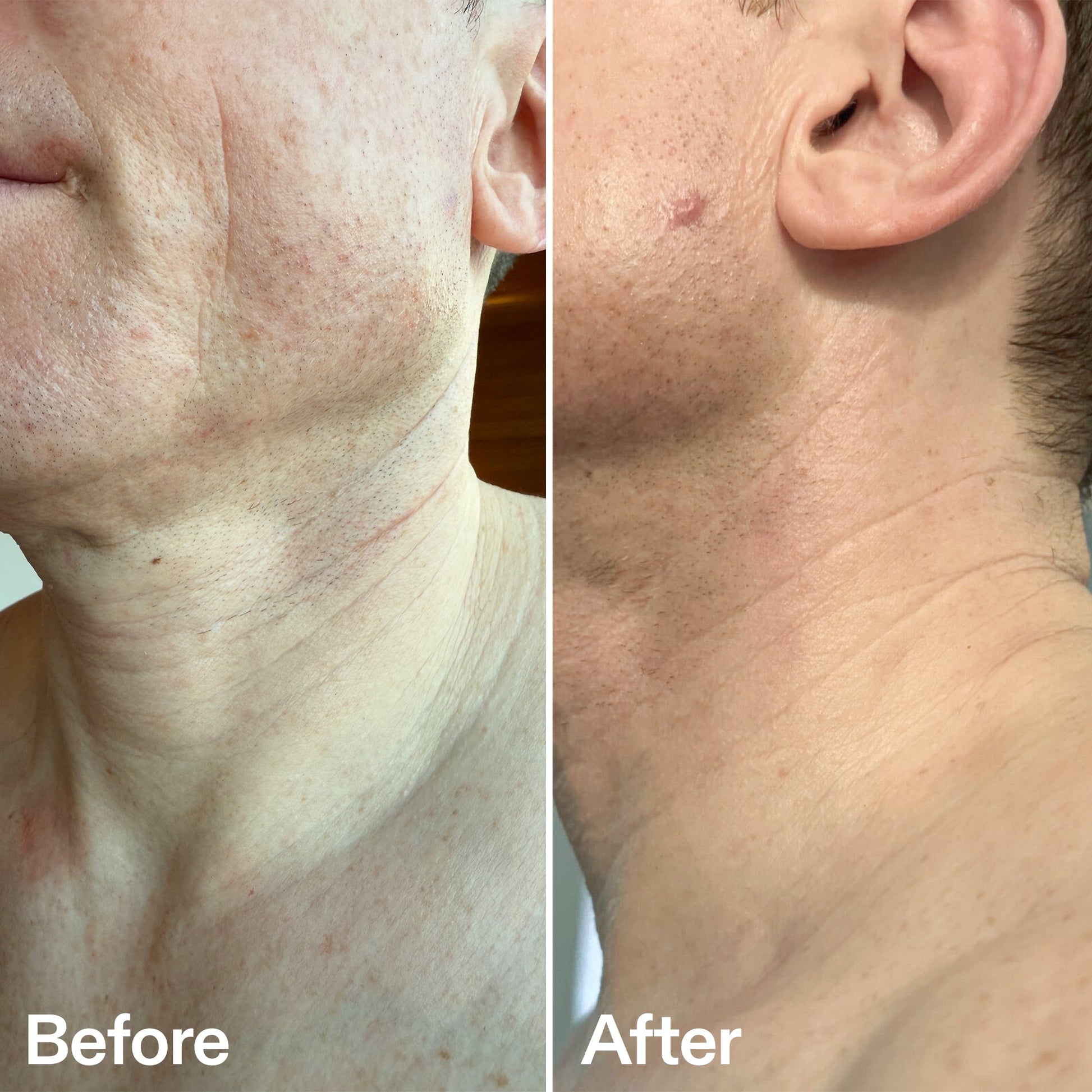bio-active-neck-lift-stick-e0 B_A_afa2743e-b8e2-4504-92f4-e281cb6cf759.jpg