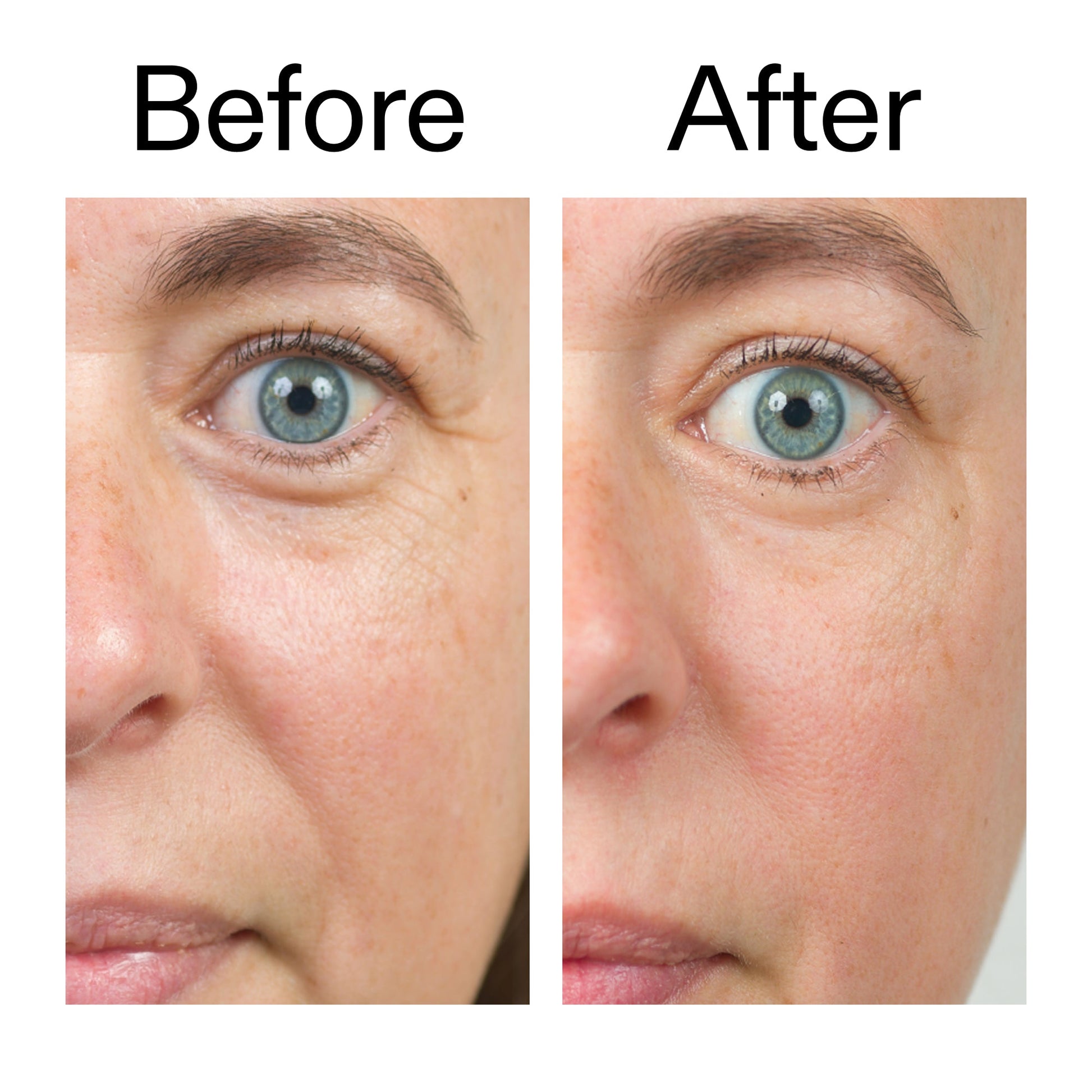 bio-active-ceramide-moisturizer-a0 Bio-Active_Before_After_2000x2000_566e5a9e-135e-417a-8242-b44e5fa35463.jpg