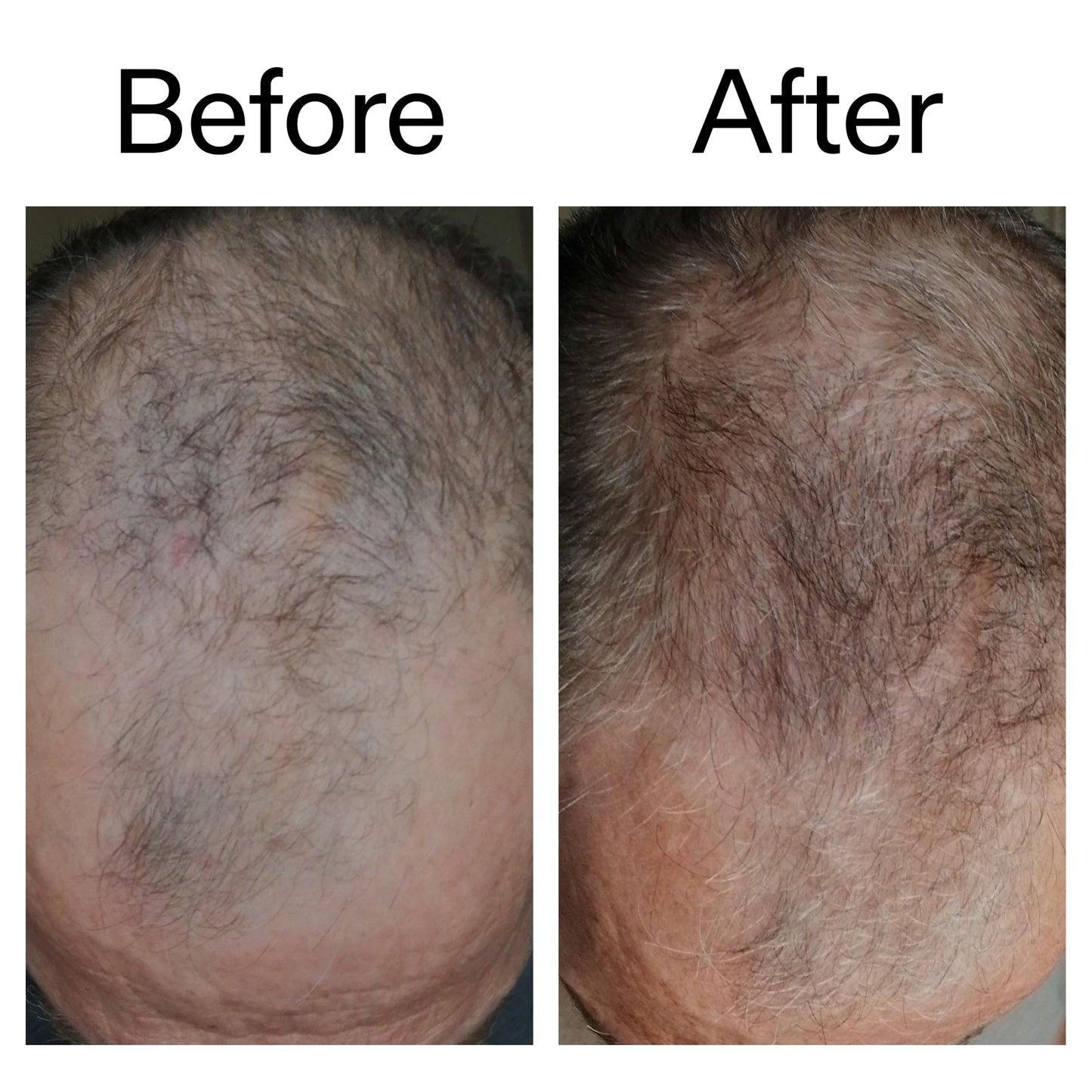 3-month-hair-growth-trio-t2 Caffeine_Scalp_Treatment_B_A_Ppage_2000_x_2000.jpg