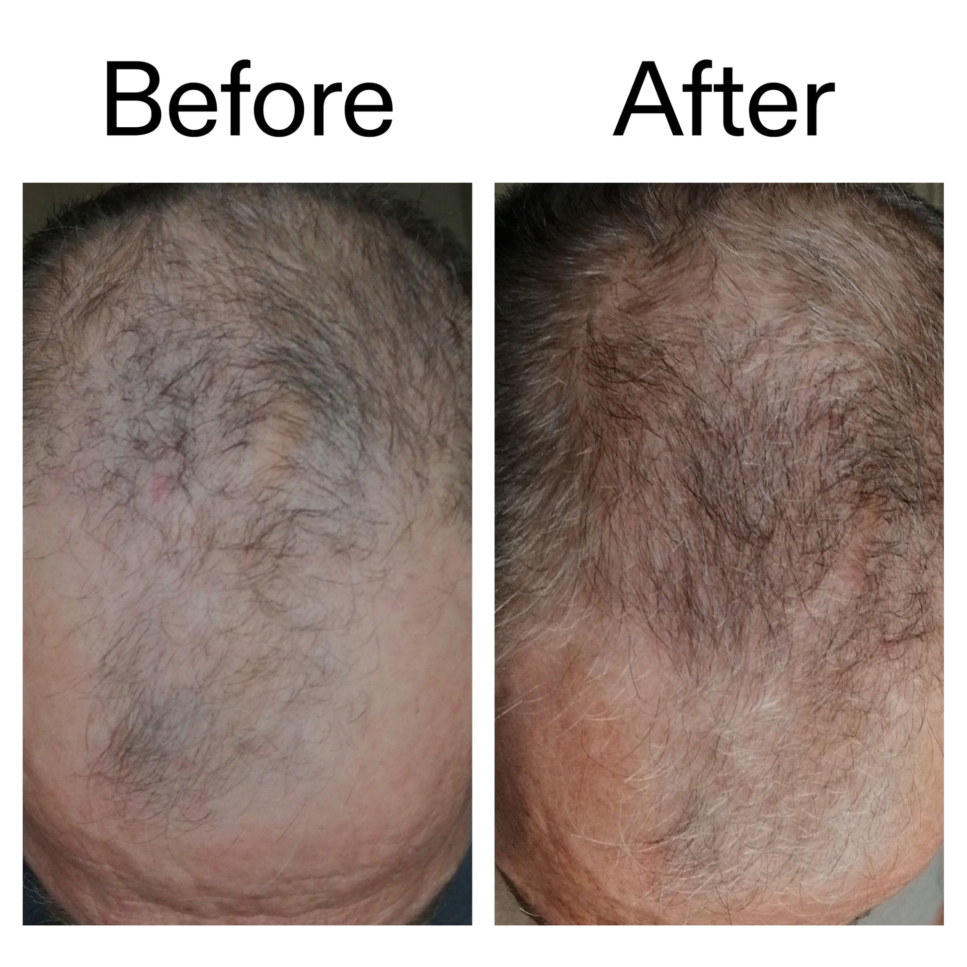 caffeine-stimulating-scalp-treatment-i7 Caffeine_Scalp_Treatment_B_A_Ppage_2000_x_2000.jpg