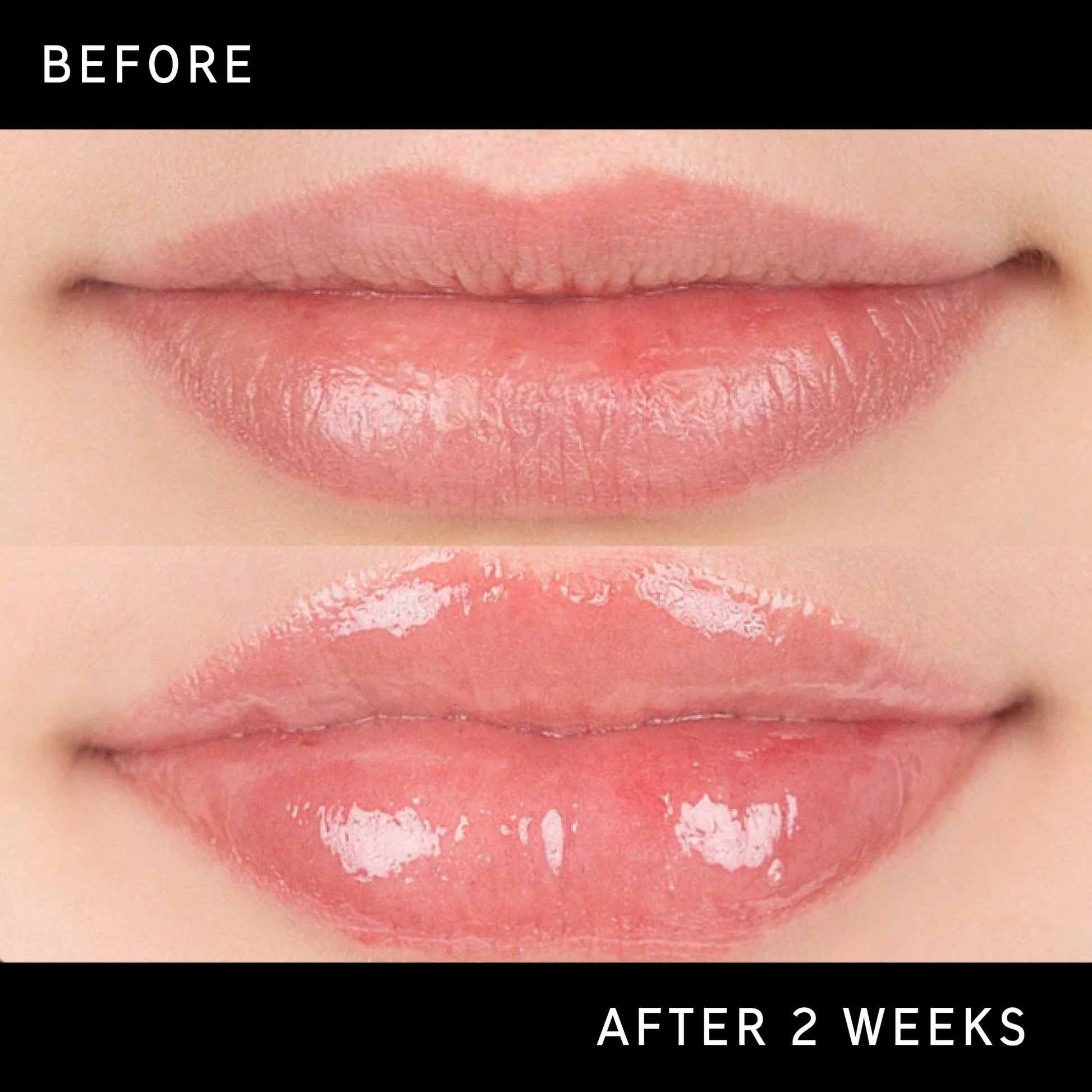lip-plumping-duo-o6 DTC-Top15_Amends_Tripeptide-Lip_B_A.jpg