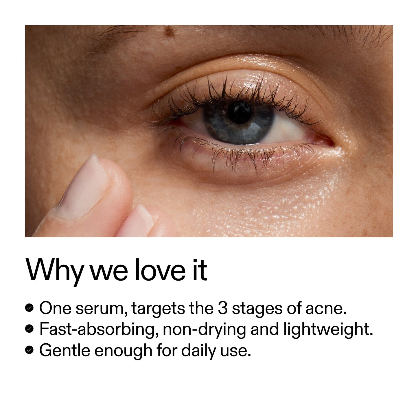 360-acne-clearing-duo-a5 Dioic_Whyweloveit_2000x2000_175aafd3-0cbe-403a-b317-a8362881bfe2.jpg