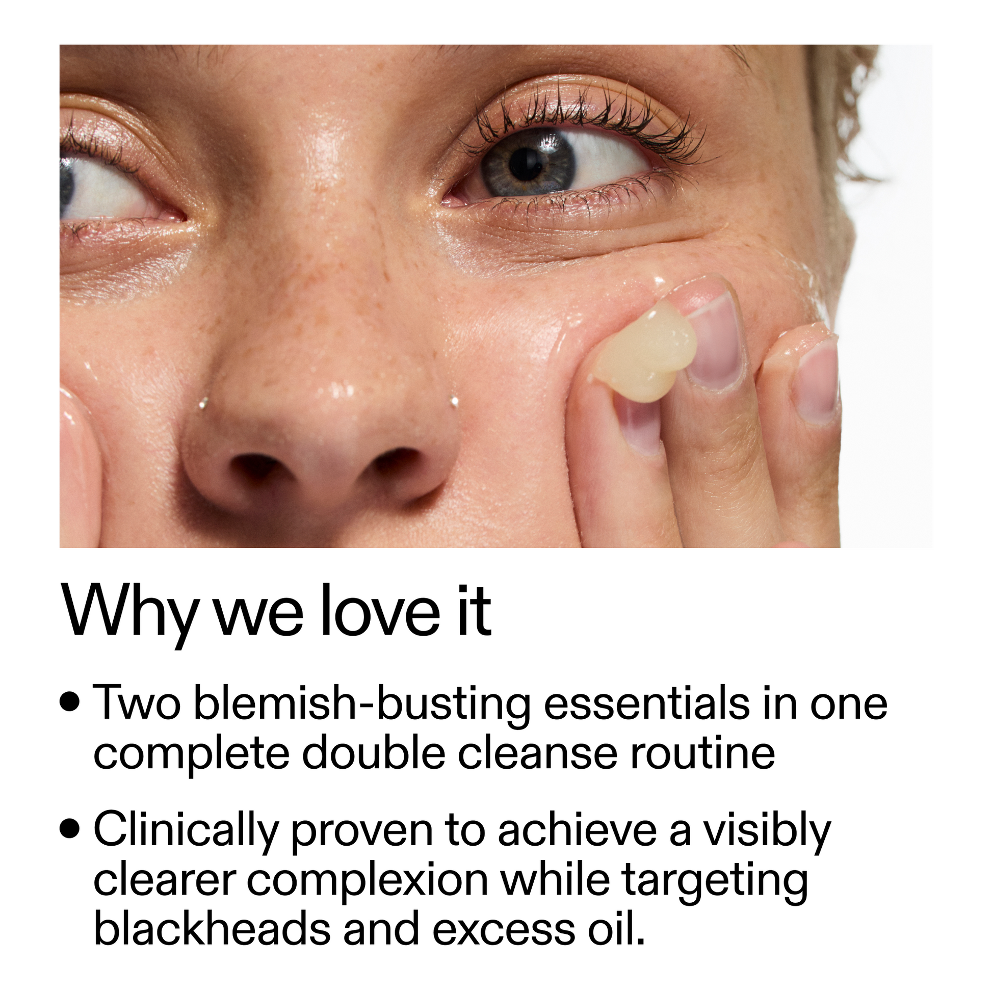 acne-double-cleanse-duo-f0 Double_Cleanse_Duo_for_Breakouts_Why_We_2000x2000_f242cb12-bb5c-487c-b203-071ccb406ec5.png