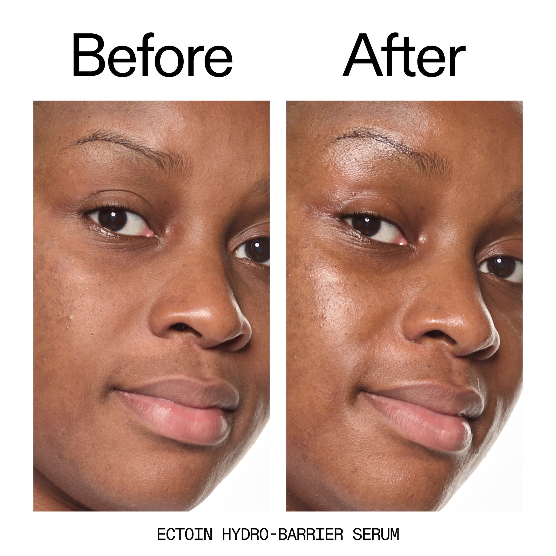 barrier-boosting-trio-k5 Ectoin_Before_After_2000x2000_ce35bc41-4da0-4b6f-adc7-29f8641f6c6c.jpg