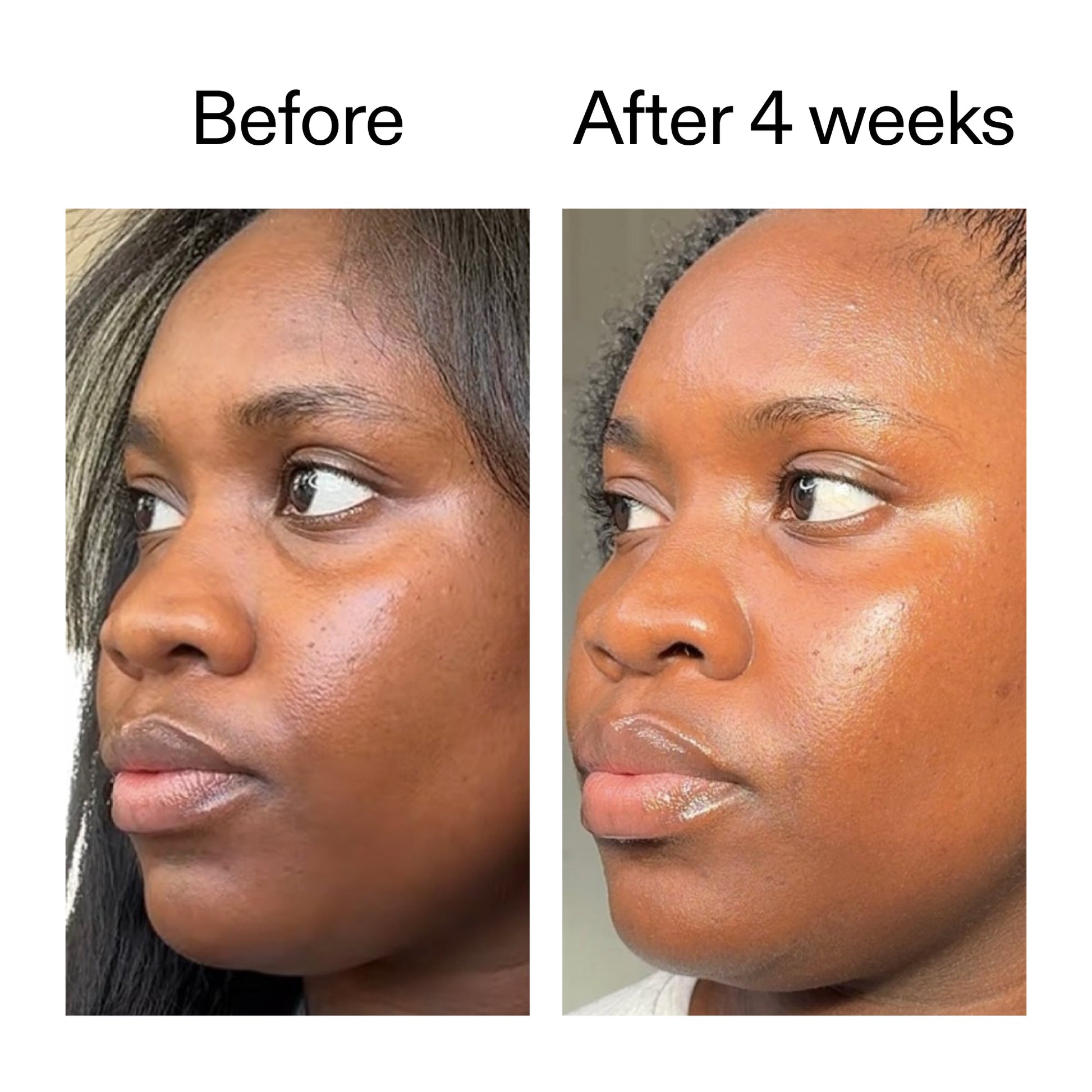 exosome-hydro-glow-complex-duo-x6 Exosome_Before_After_V12_2000x2000_2e7d50e1-0ed9-4624-91c6-1f94c0266a04.jpg
