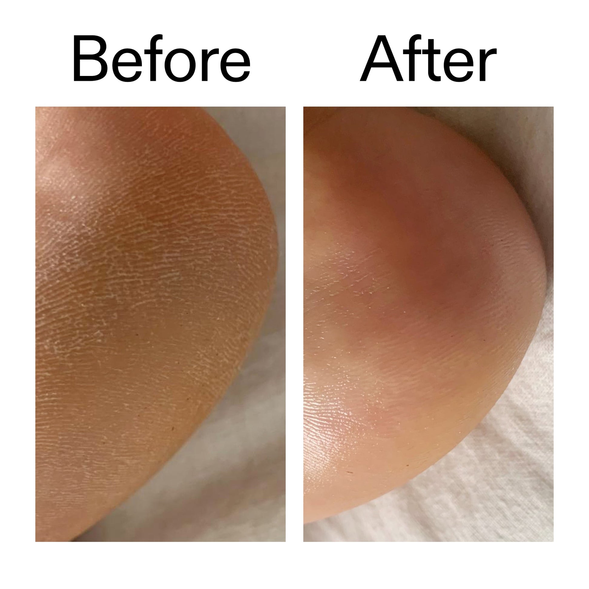 glycolic-acid-exfoliating-body-stick-duo-v8 Glycolic_Acid_Exfoliating_Body_Stick_Before_After_V1_2000x2000_a3043625-9400-429a-a7fb-d6dbd220f722.jpg