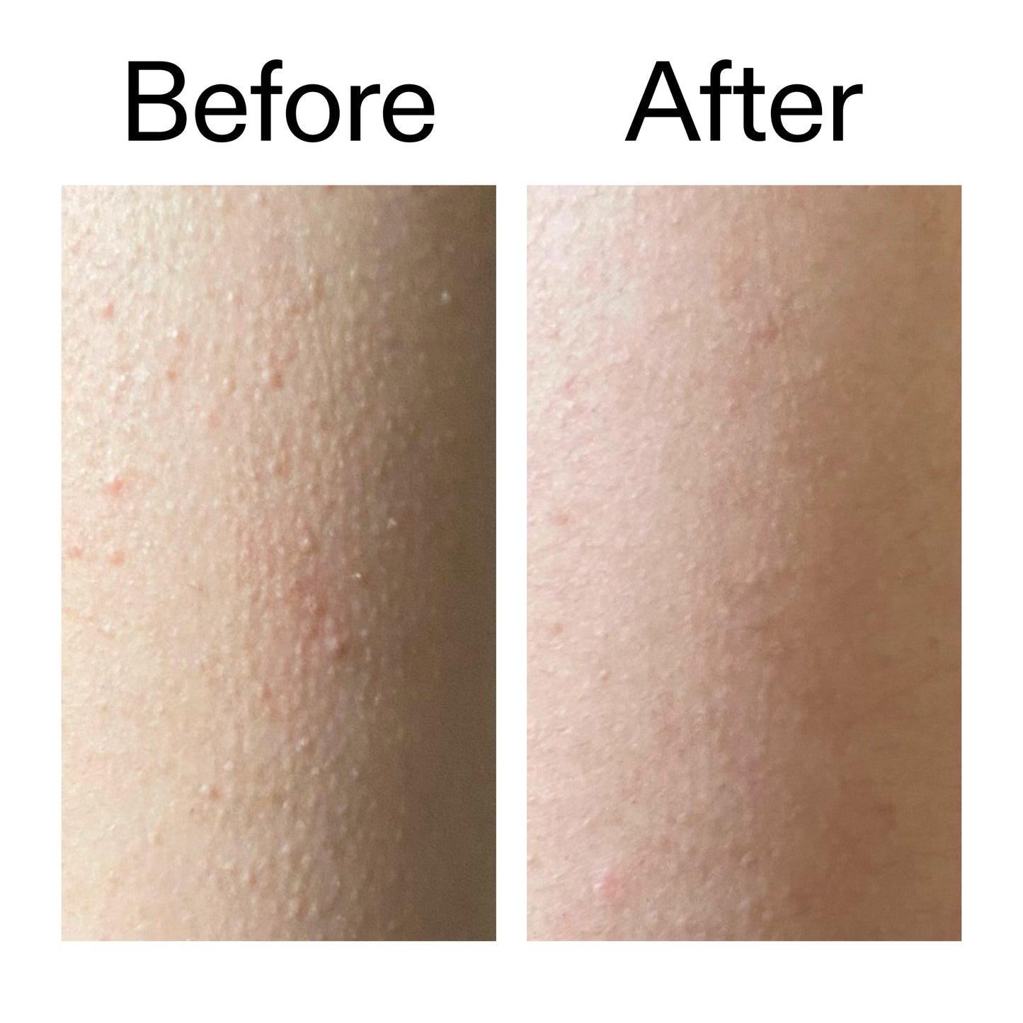 glycolic-acid-exfoliating-body-stick-p8 Glycolic_Acid_Exfoliating_Body_Stick_Before_After_V2_2000x2000_2e4ba052-94f6-4d56-82df-7bdb5b2df7ae.jpg
