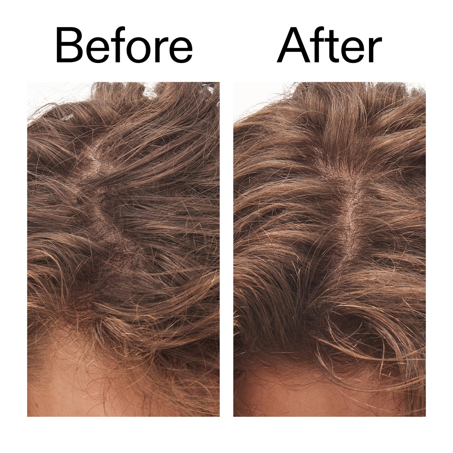 glycolic-acid-exfoliating-scalp-scrub-n6 Glycolic_Acid_Exfoliating_Scalp_Scrub_Before_After_2000x2000_b8561c87-05a1-4caa-80f7-1b6b33d750f7.jpg