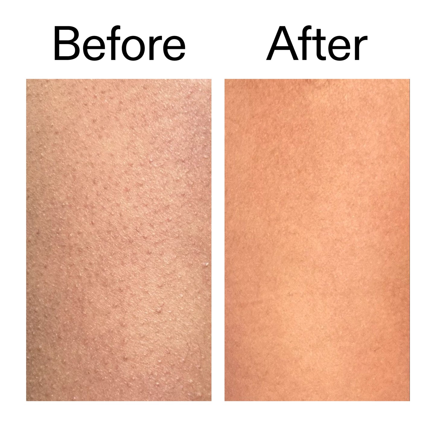 glycolic-acid-exfoliating-body-stick-p8 Glycolic_Body_Stick_B_A_2000x2000_6e6e6b4d-5bd7-43c0-aeed-4d66788e8995.jpg