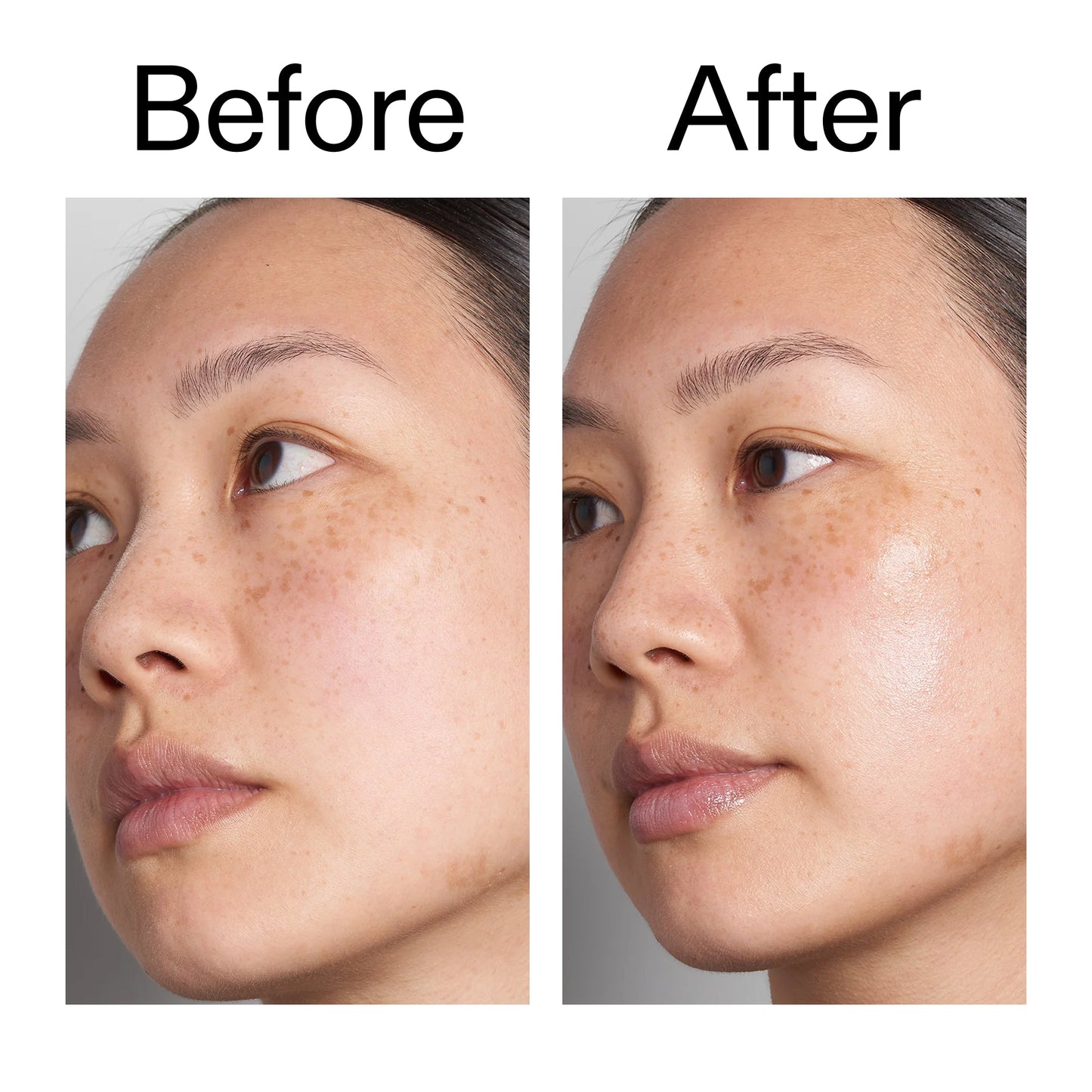 supersize-hyaluronic-acid-serum-100ml-o5 Hyaluronic_Acid_Before_After_2000x2000_d7983956-8aa2-4ea3-8255-c63e8d4f892e.jpg