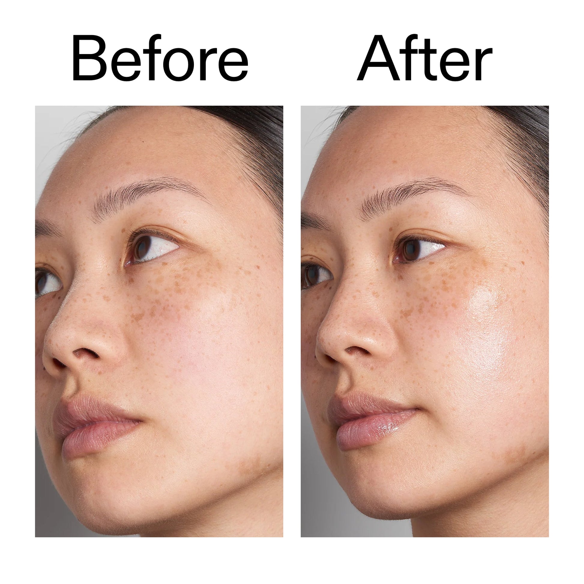hyaluronic-acid-serum-30ml-n1 Hyaluronic_Acid_Before_After_2000x2000_d7983956-8aa2-4ea3-8255-c63e8d4f892e.jpg