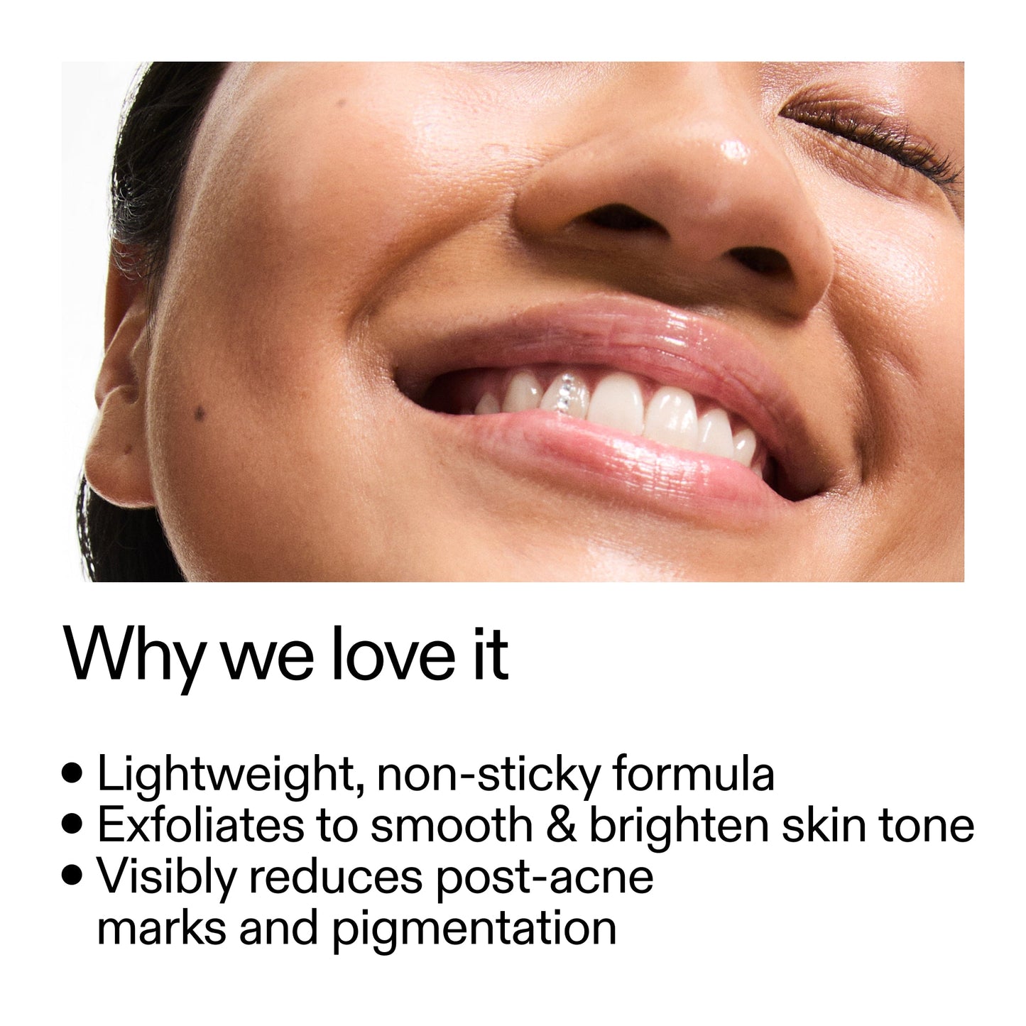 mandelic-acid-treatment-m5 Mandelic_Acid_Treatment_Why_we_love_it_2000x2000_6dfe29a9-2a79-464f-a5e8-e5ac37d93388.jpg