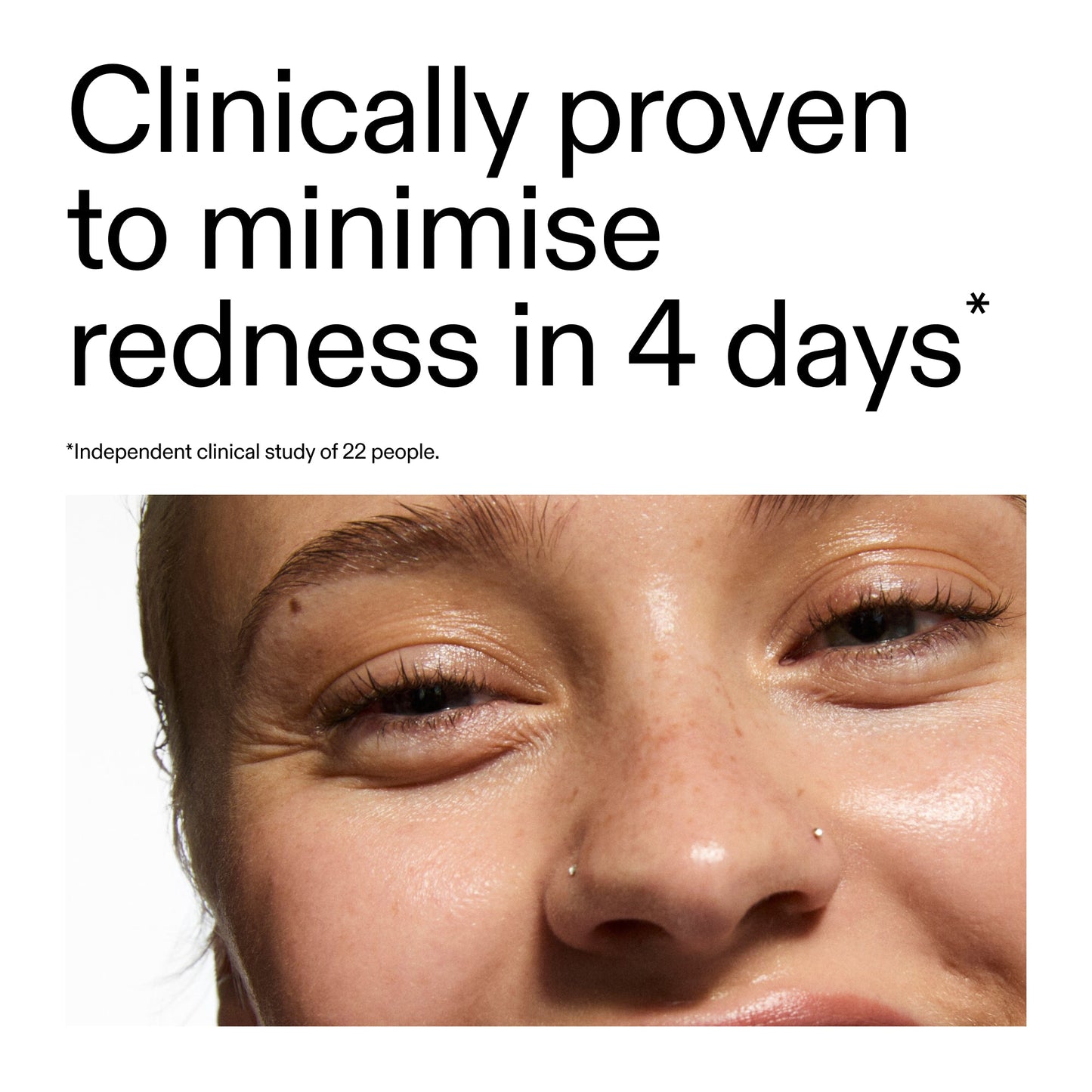 10-azelaic-acid-serum-for-redness-relief-w4 Oat_Cleansing_Balm_Claim_2000x2000_52a841dc-353c-4f2c-8646-3aadb604507d.jpg