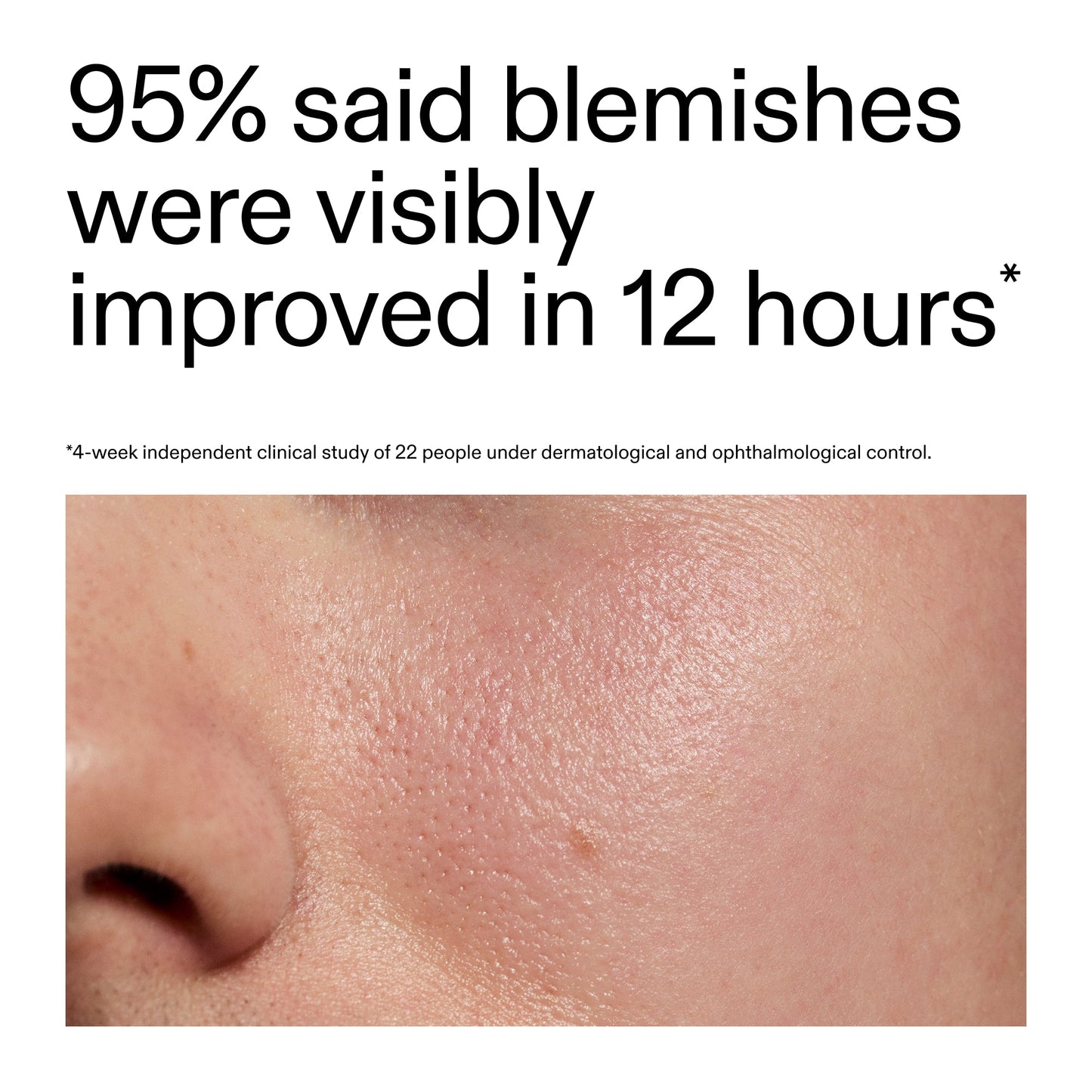 succinic-acid-acne-treatment-o2 Oat_Cleansing_Balm_Claim_2000x2000_ac6ce553-25db-41b2-a981-faae1ac4b8c0.jpg