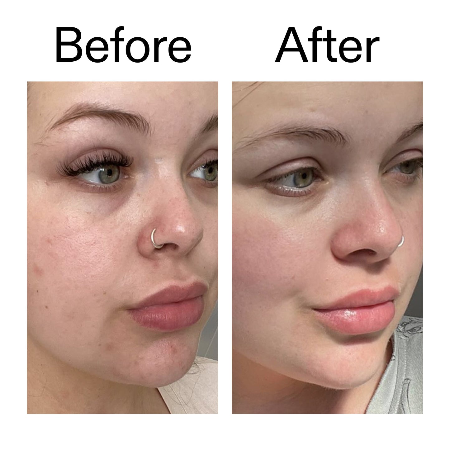supersize-omega-water-cream-duo-p0 Omega50_Before_After_2000x2000_46483ed8-3f9d-487f-9a0c-9df79830bd65.jpg