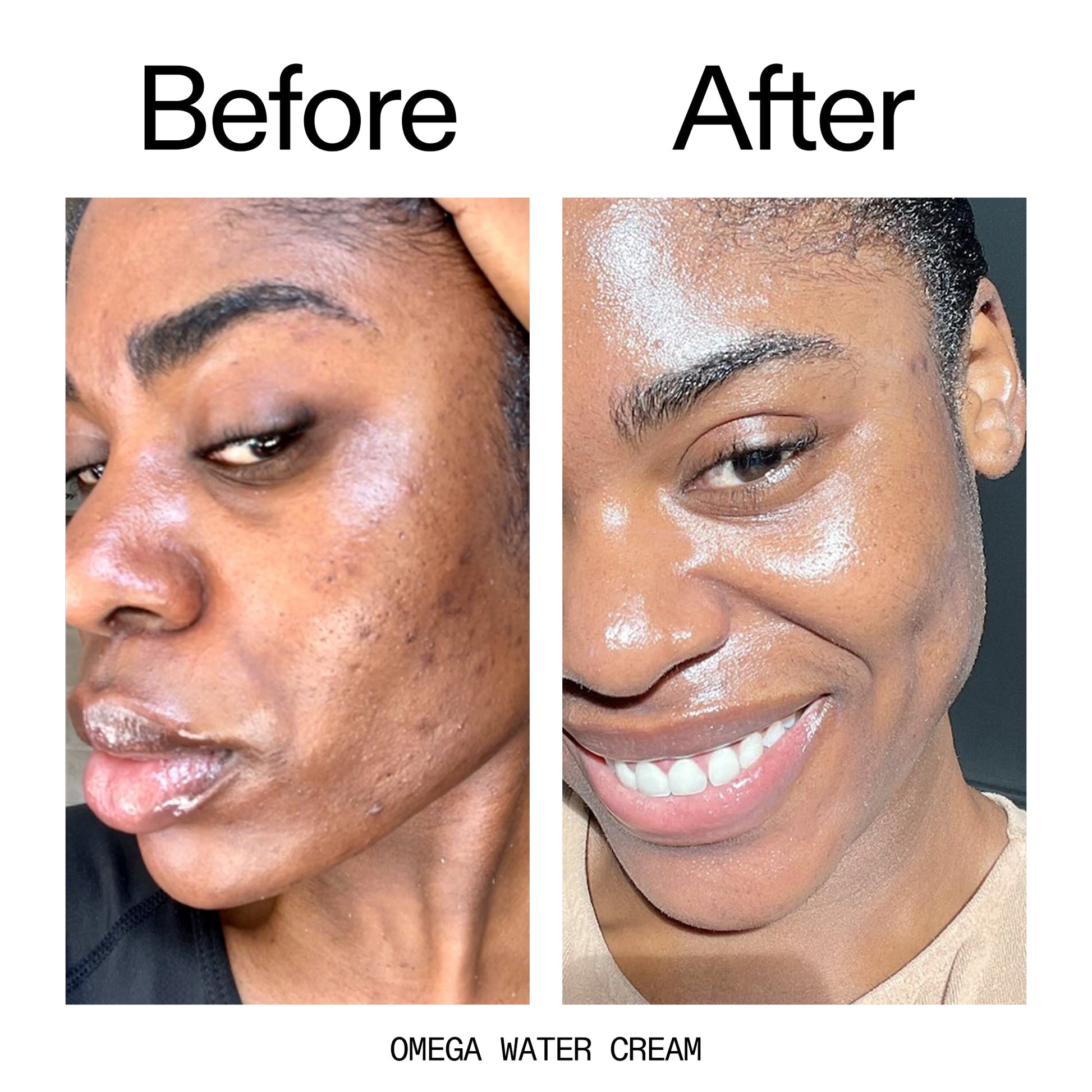hydrating-cleanser-and-moisturizer-duo-x2 Omega_Water_Cream_Before_After_2000x2000_8e88278b-8c8d-48dc-ac77-4e98ebbd1b77.jpg