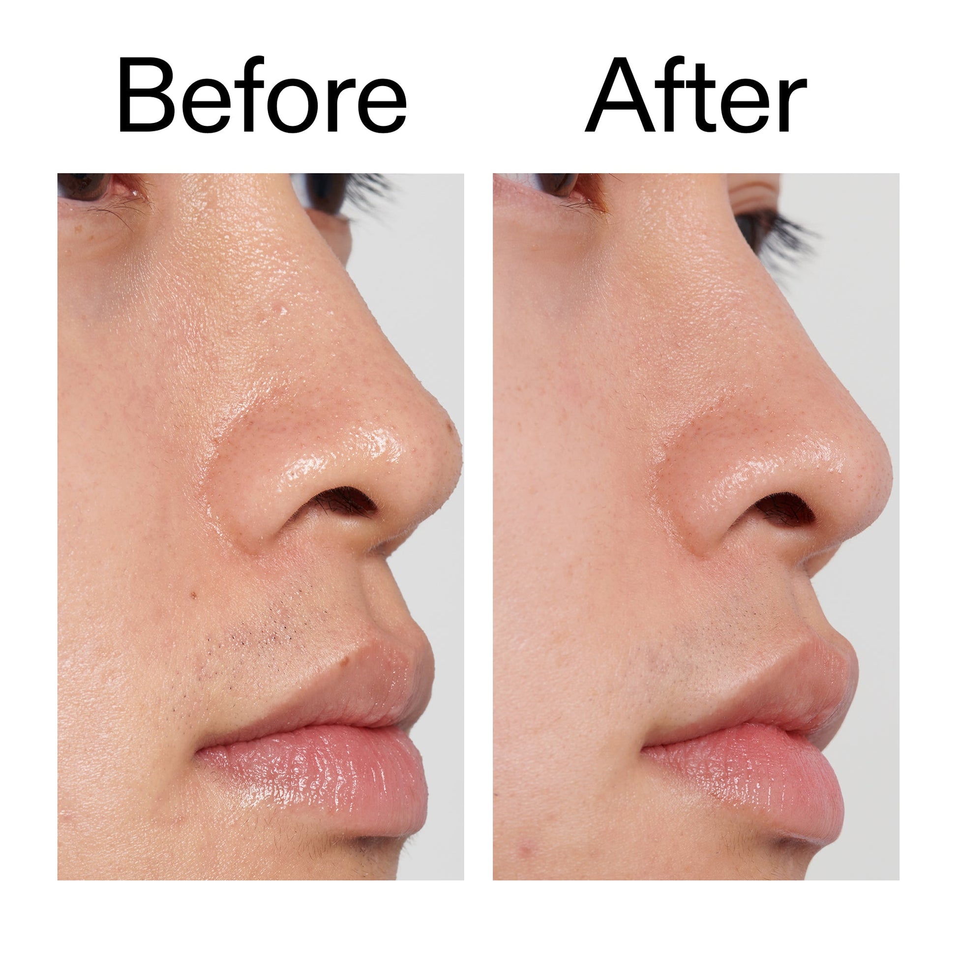 pha-toner-y4 PHA_Toner_Before_After_2000x2000_e3c10172-0150-4342-8b95-57417eaff50d.jpg