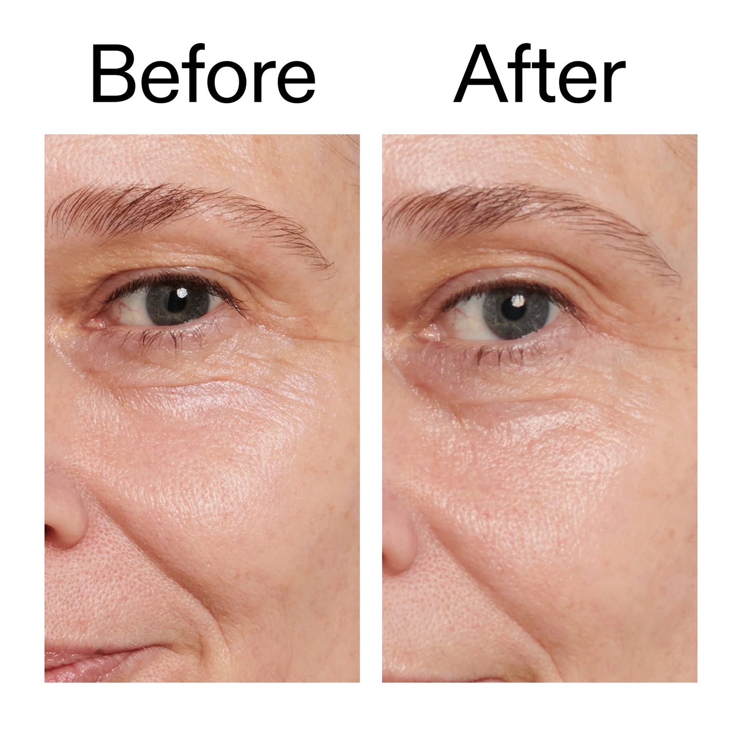 retinol-eye-cream-z9 Retinol_Eye_Cream_Before_After_2000x2000_ac03a80c-109e-4572-a95a-91dc109b4d27.jpg