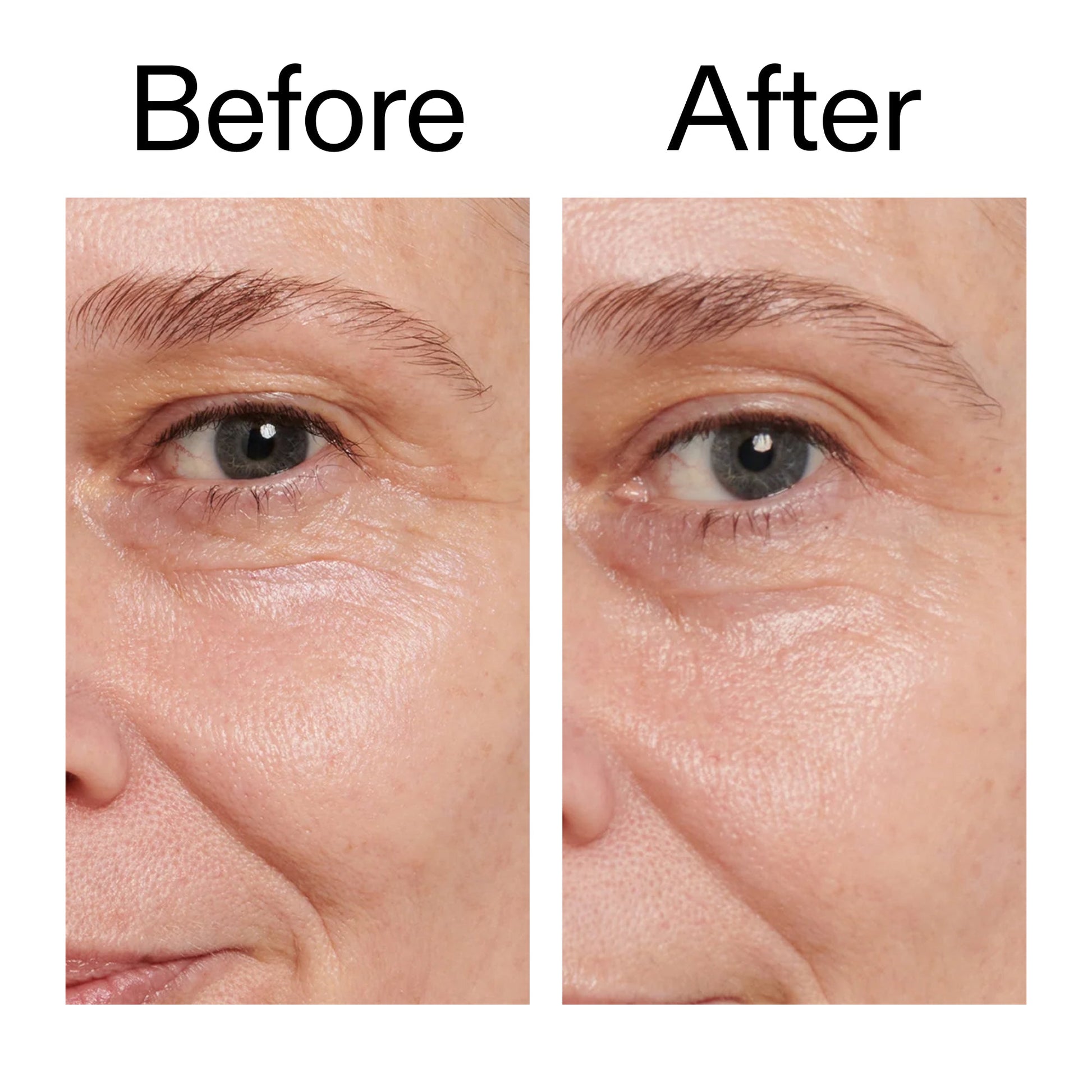 retinol-eye-cream-z9 Retinol_Eye_Cream_Before_After_2000x2000_ac03a80c-109e-4572-a95a-91dc109b4d27.jpg