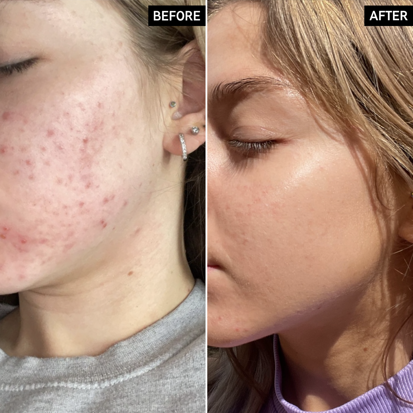 deep-cleanse-duo-m7 SITE-12xUGCB_AsforPpages_Shannon_B_A_PPage_2000x2000_db99c152-d515-471e-b6f6-8865428952cc.png