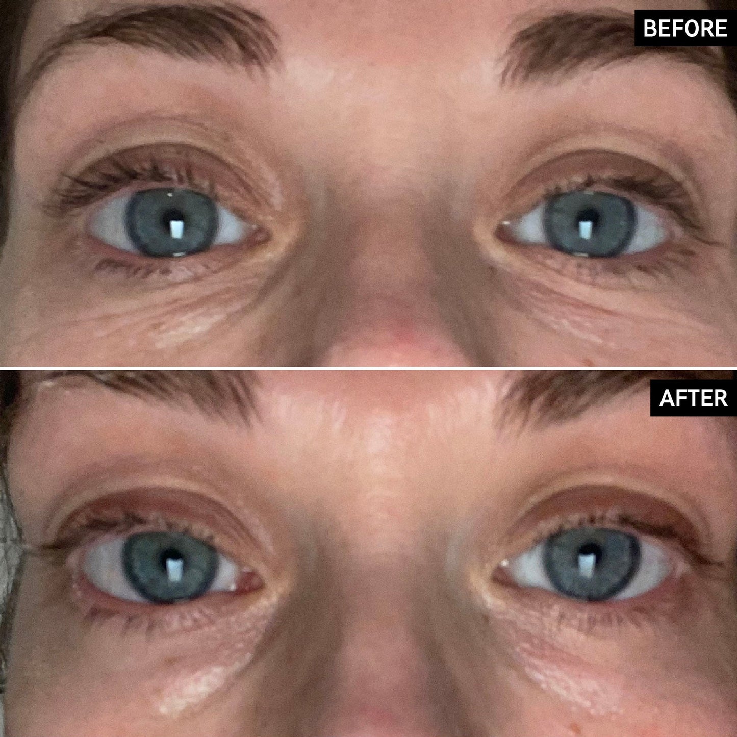 retinol-eye-cream-z9 SITE-UGCBAsApril_Nicole_B_A_PPage_2000x2000_1.jpg