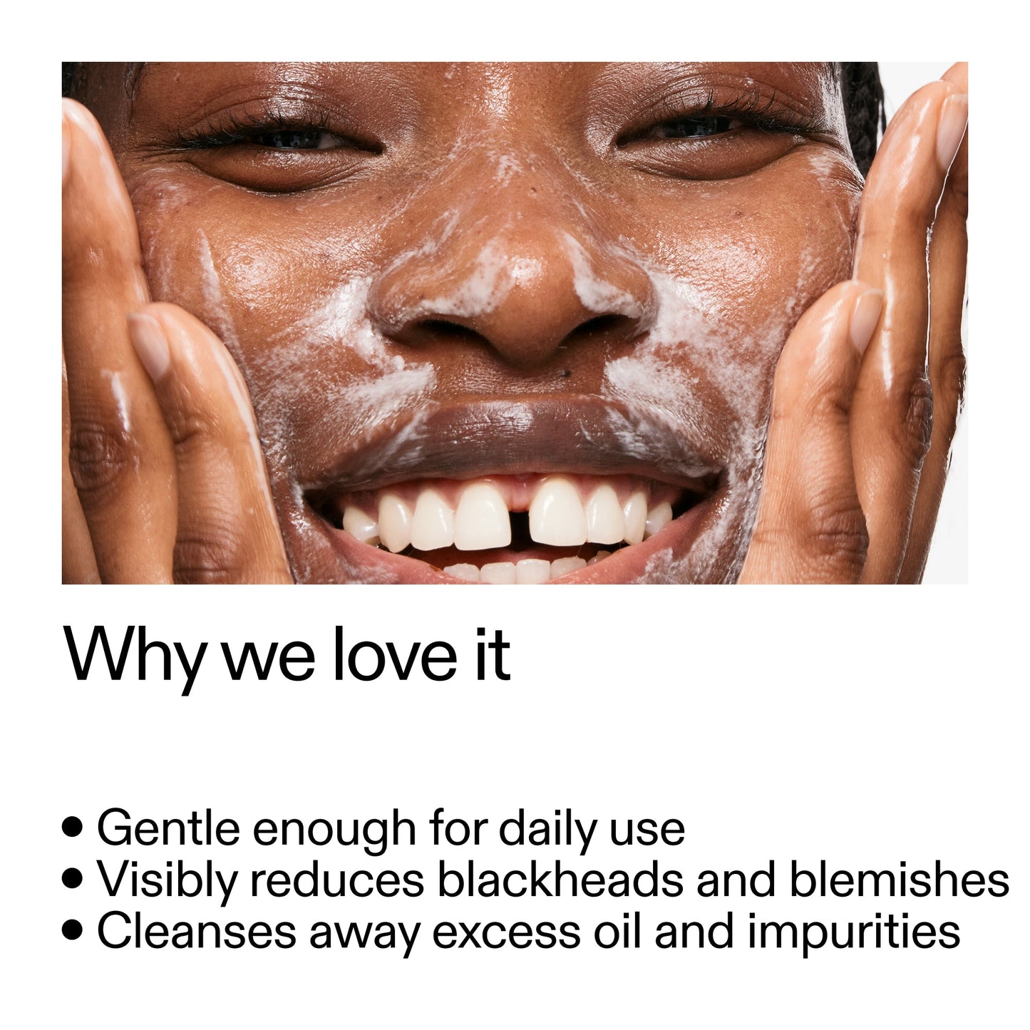 salicylic-acid-cleanser-150ml-m1 Salicylic_Acid_Cleanser_-_300mlWhy_we_love_it_2000x2000_87dc92a9-2559-4309-98cd-4e570f1be735.jpg