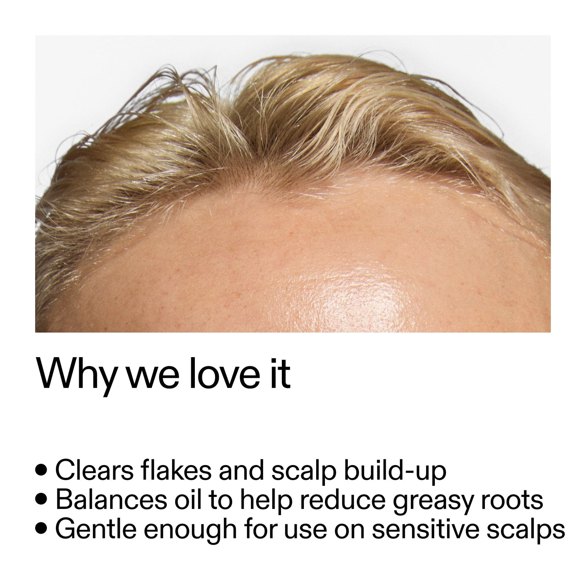 salicylic-acid-exfoliating-scalp-treatment-y8 Salicylic_Acid_Exfoliating_Scalp_Treatment_Why_we_love_it_2000x2000_44b6bd6d-9ec4-4b23-9dc4-bc3fd6f28e14.jpg
