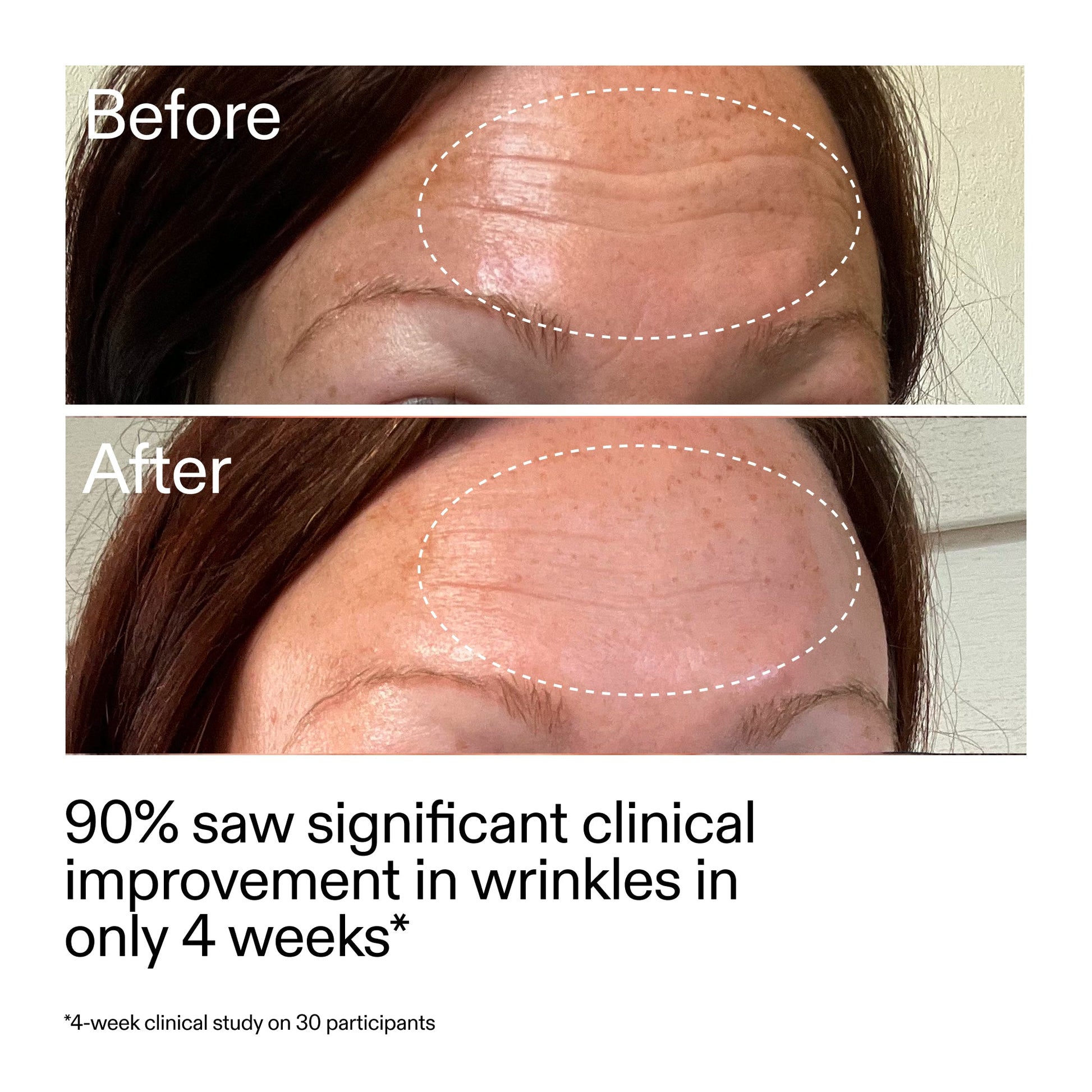 starter-retinol-serum-duo-p4 StarterRetinol_BeforeAfter_Claim1_2000x2000_03b4d6e5-a357-43b9-a855-aba5e35c57f3.jpg