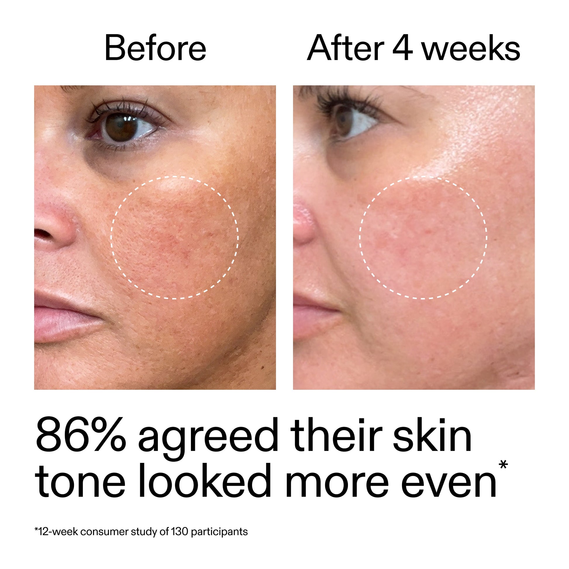 starter-retinol-serum-duo-p4 StarterRetinol_BeforeAfter_Claim2_2000x2000_fc5bb8ac-8588-478f-98d5-28af6651601a.jpg