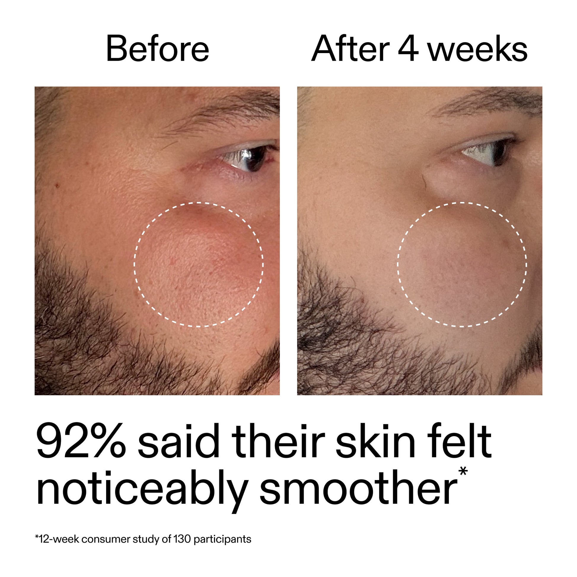 starter-retinol-serum-k0 StarterRetinol_BeforeAfter_Claim3_2000x2000_6ceab106-e0ee-4ed4-ba62-41bc39538038.jpg