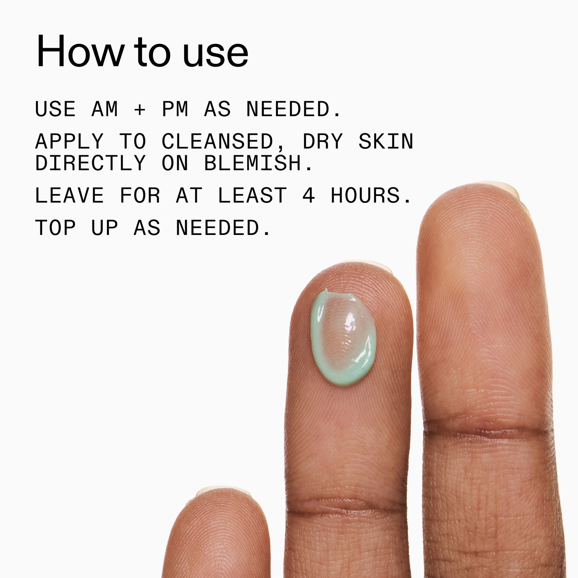 succinic-acid-acne-treatment-o2 Succinic_Acid_Treatment_How_to_Use_2000x2000_d57137d5-d7f1-427c-9a46-5fc00c19c542.jpg