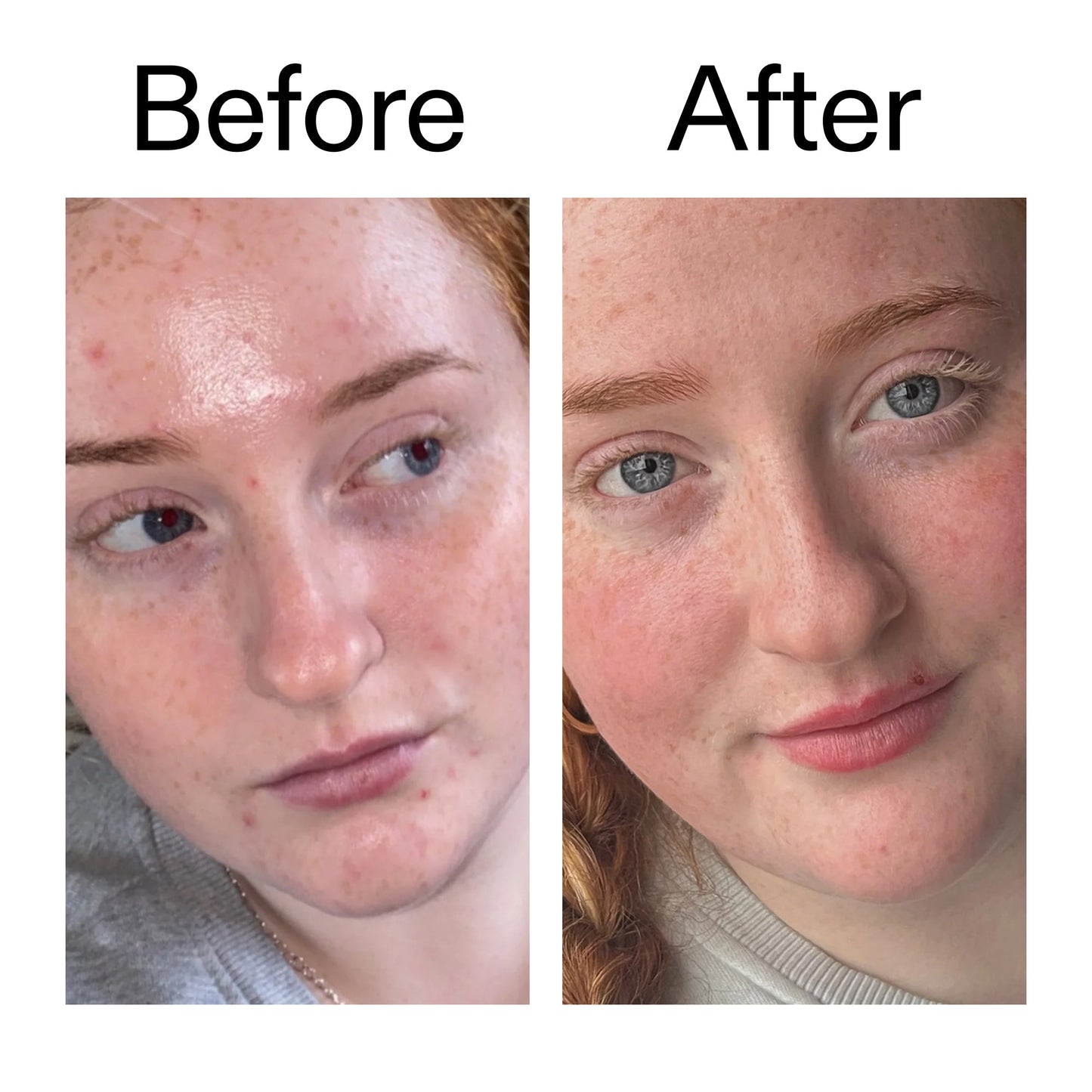 vitamin-b-c-and-e-moisturizer-m3 Vitamin_B_C_and_E_Moisturizer_Before_After_2000x2000_b0781a76-5ad2-4be9-95b8-ef92b356833c.jpg